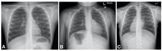 Children 08 00153 g002 550