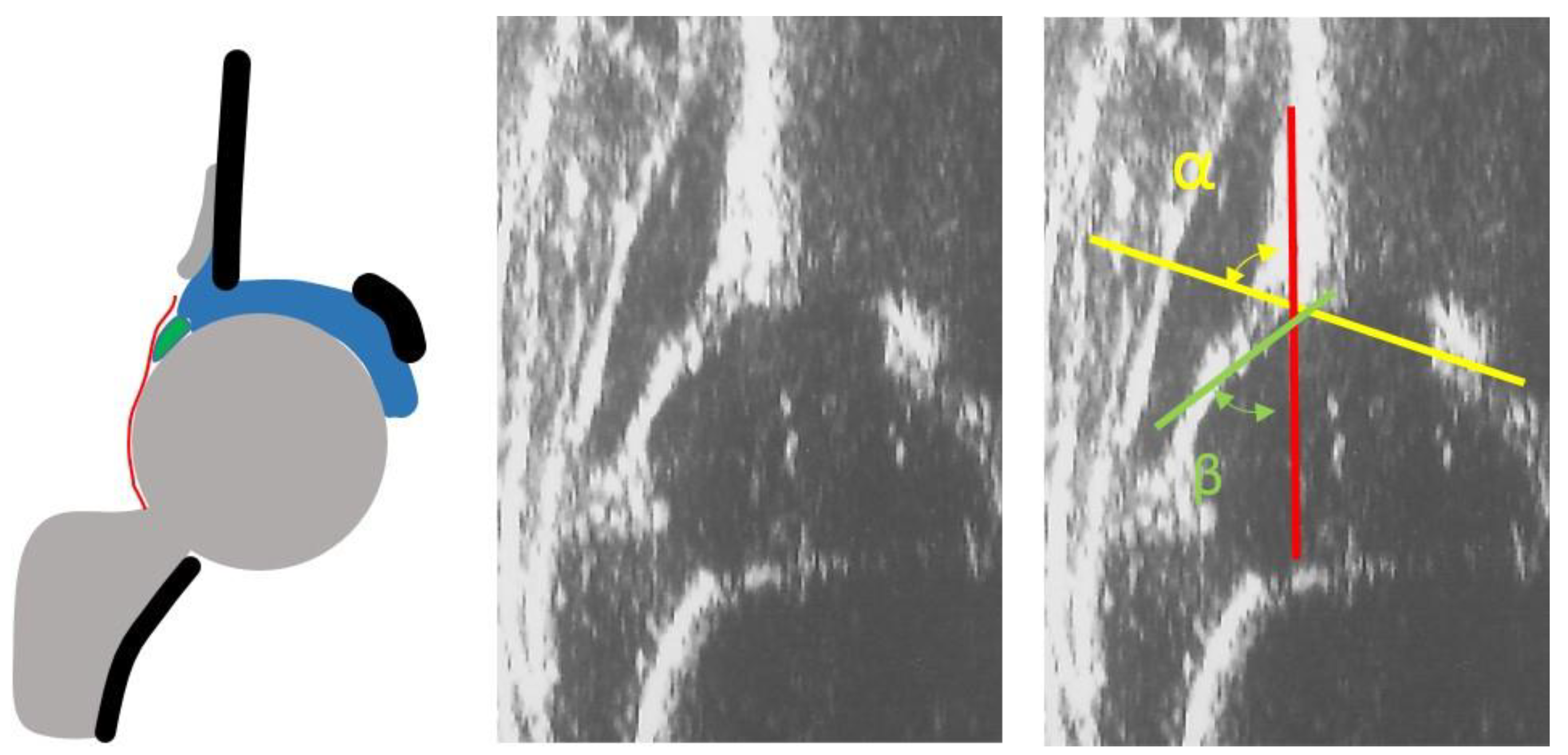 Children 08 00179 g001