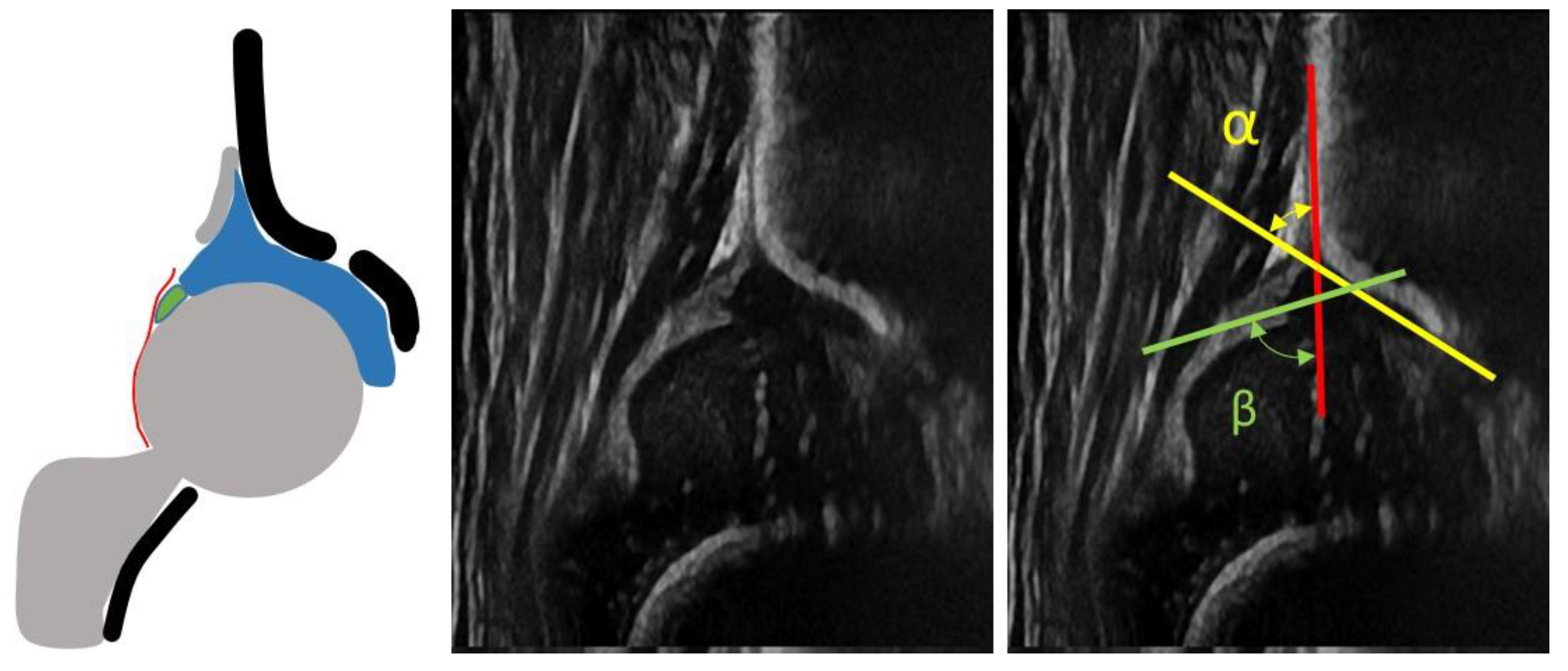 Children 08 00179 g005