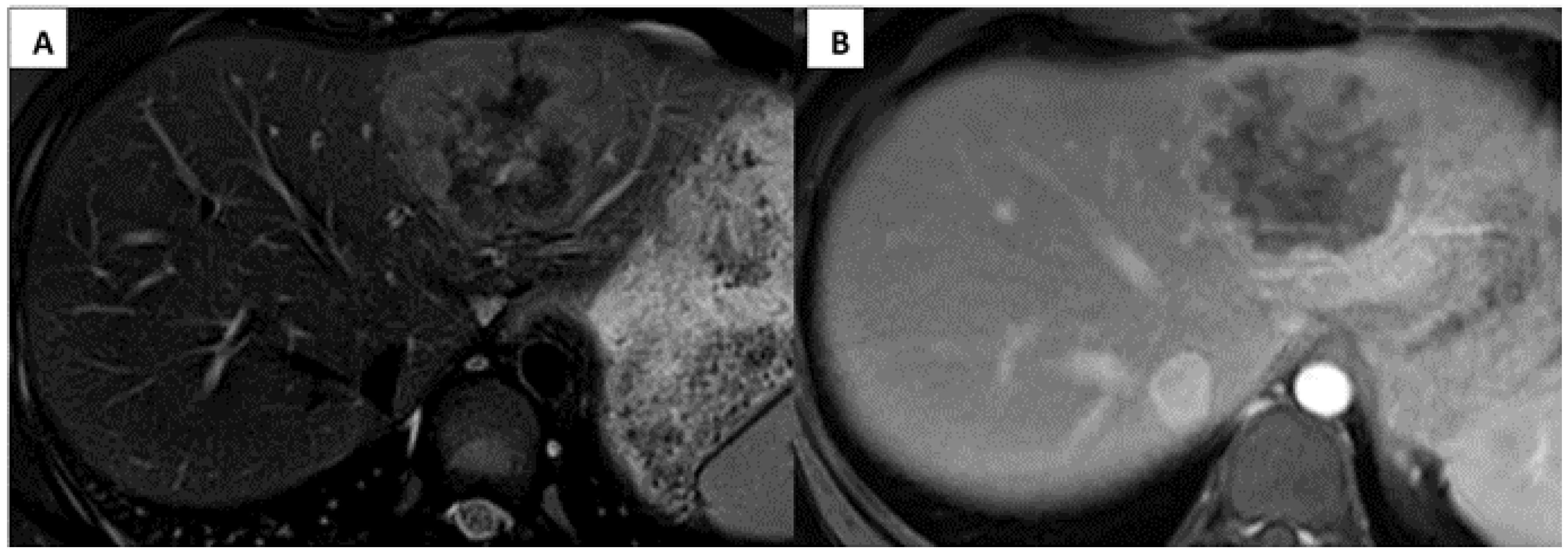 Children 08 00226 g001