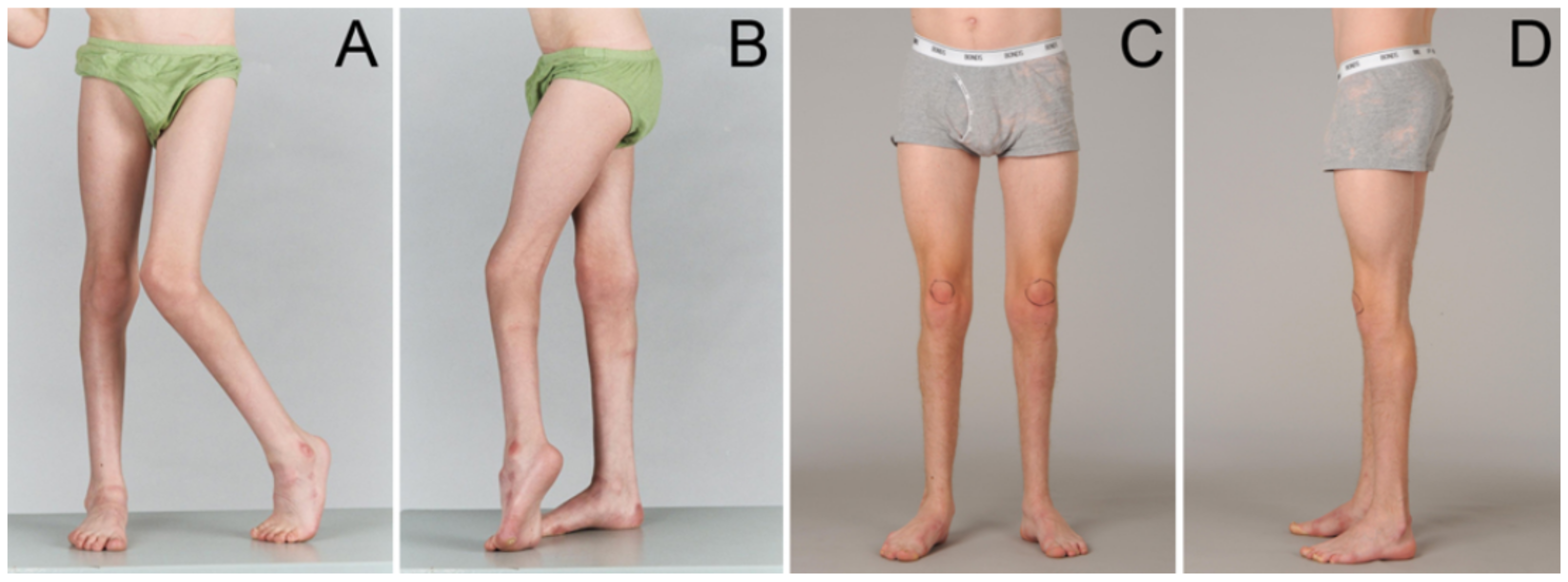 Children 08 00252 g003 Children 08 00252 g003