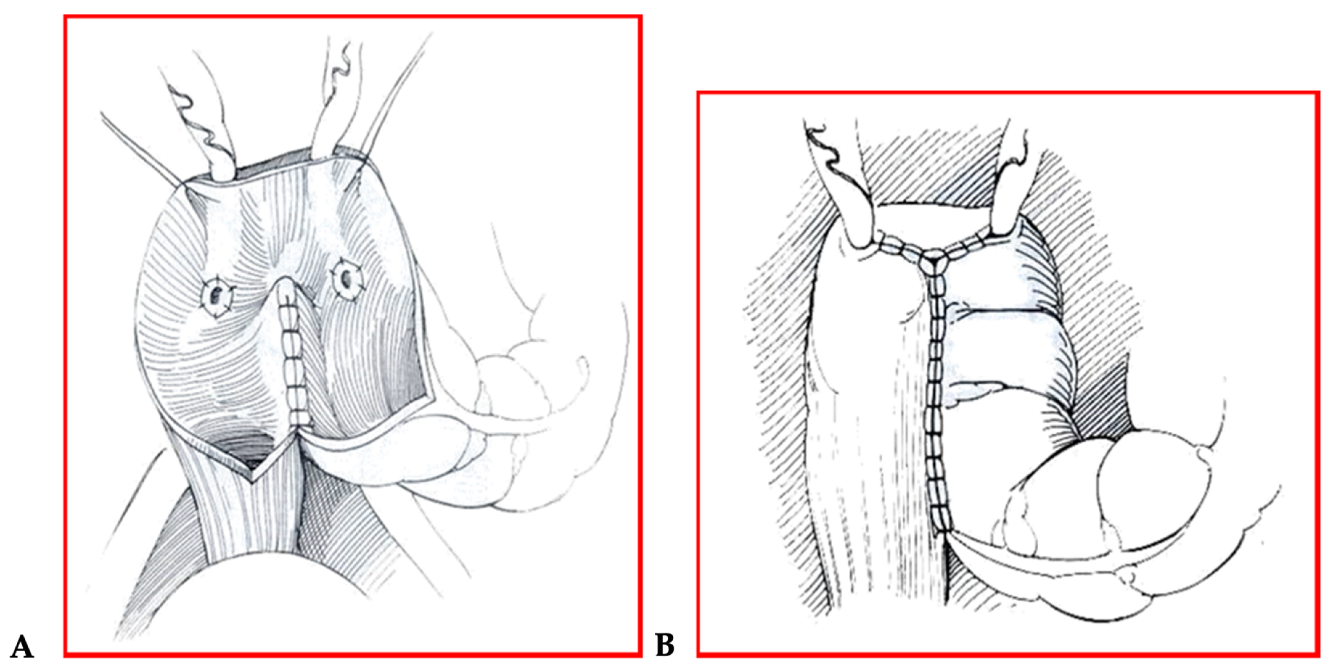 Children 08 00279 g001