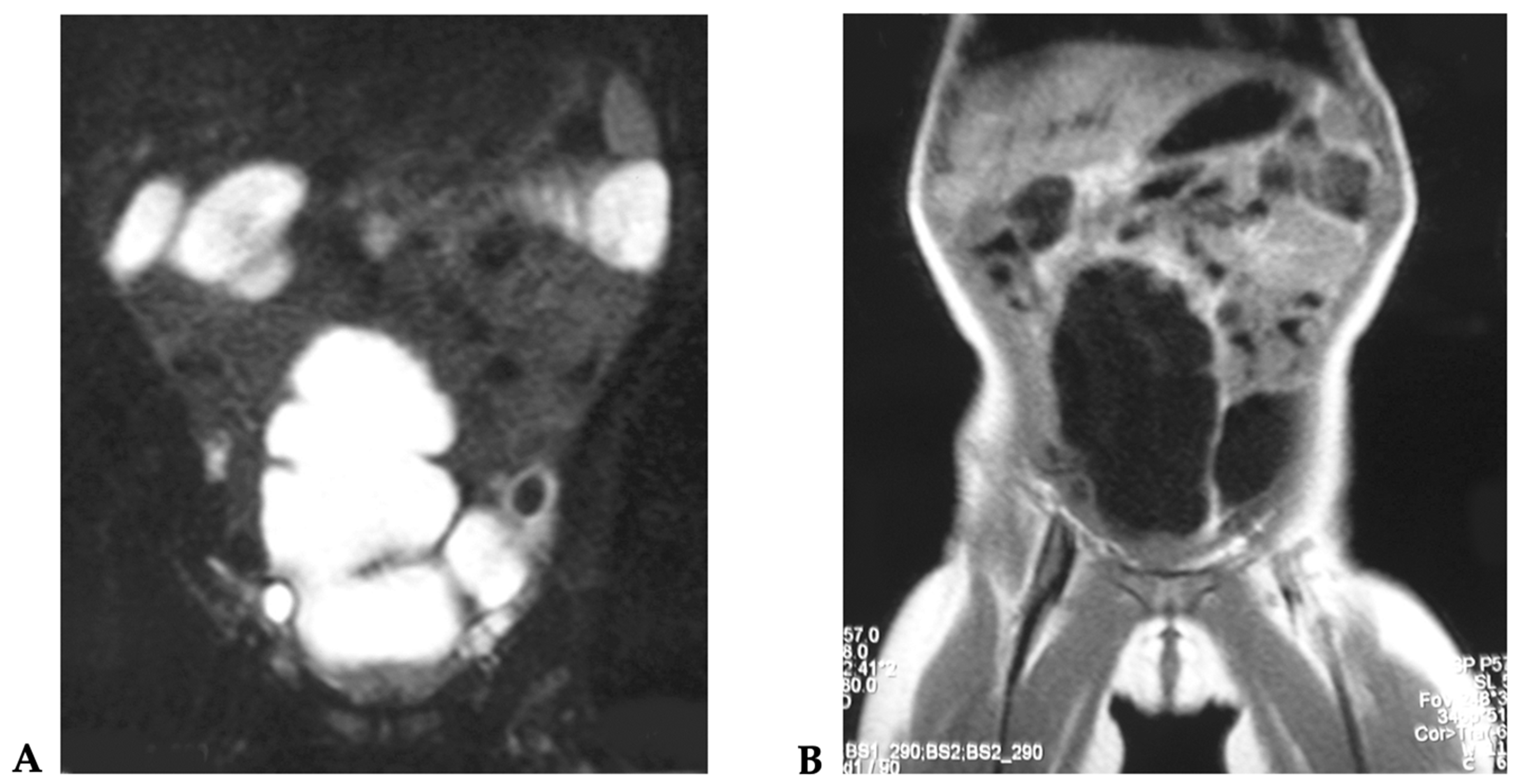 Children 08 00279 g002