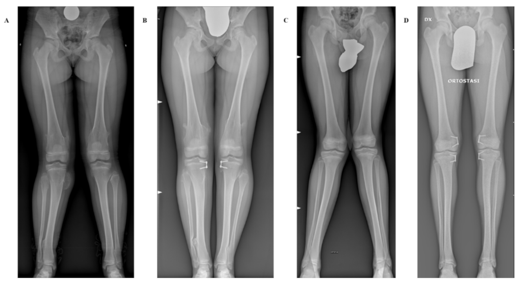 Children 08 00287 g004