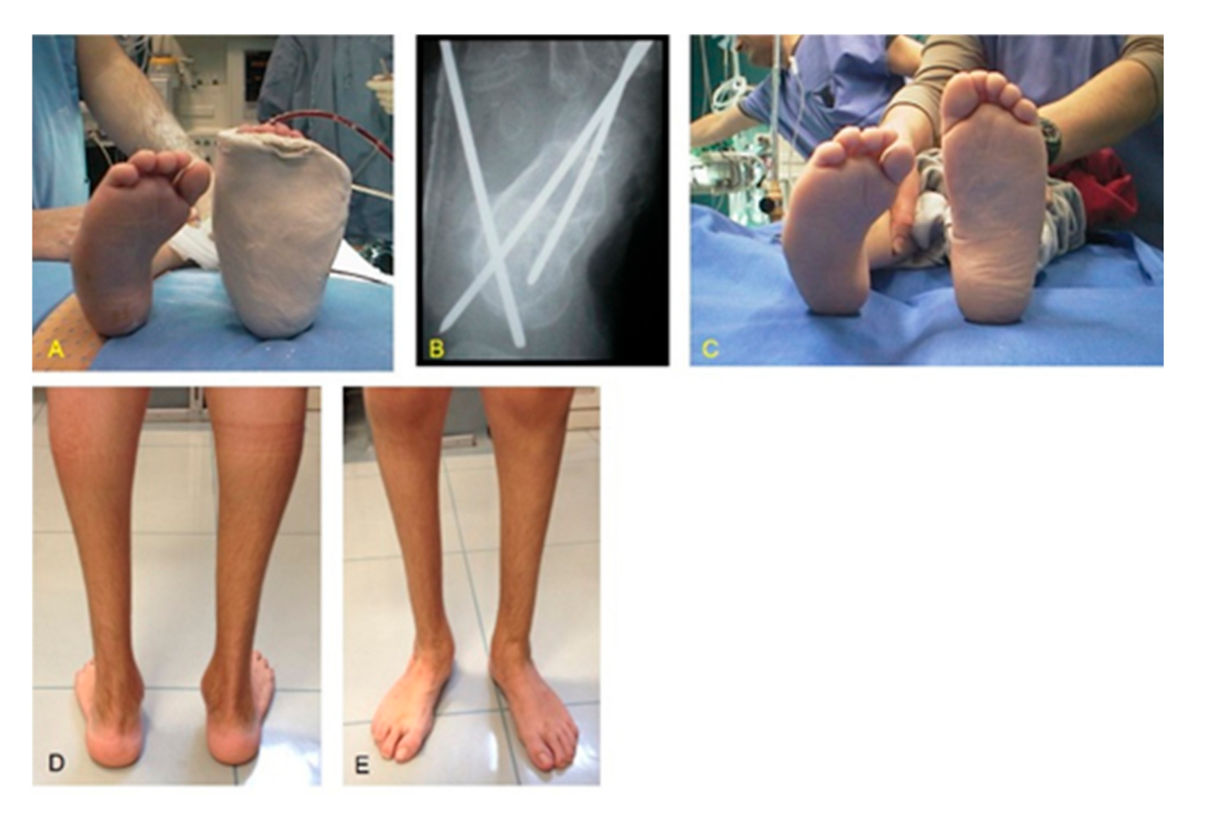 Children 08 00310 g003