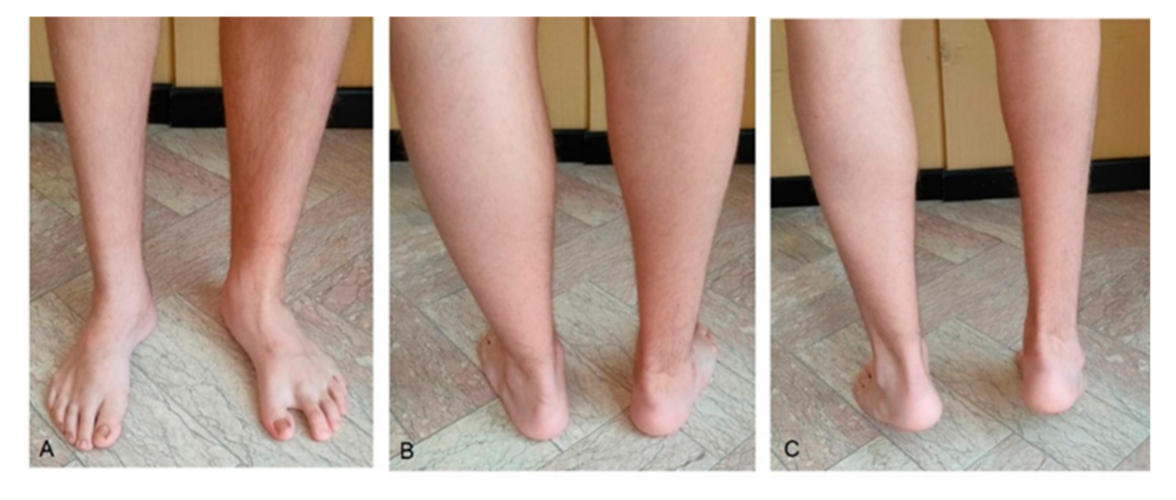 Children 08 00310 g004