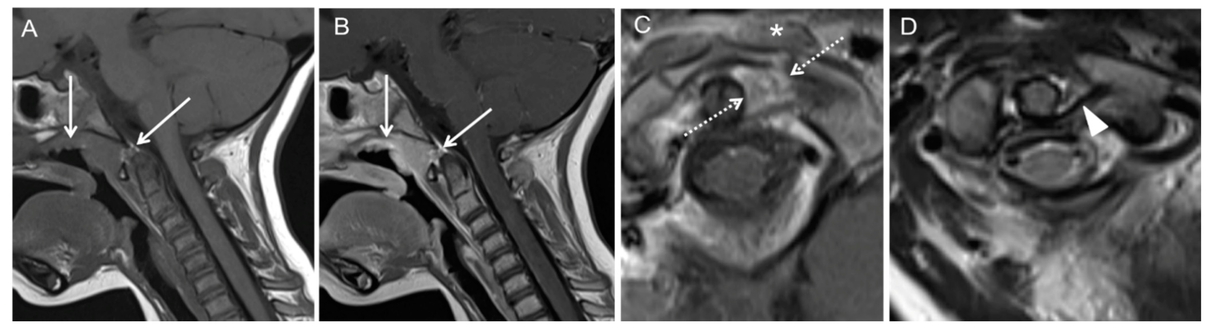 Children 08 00329 g003