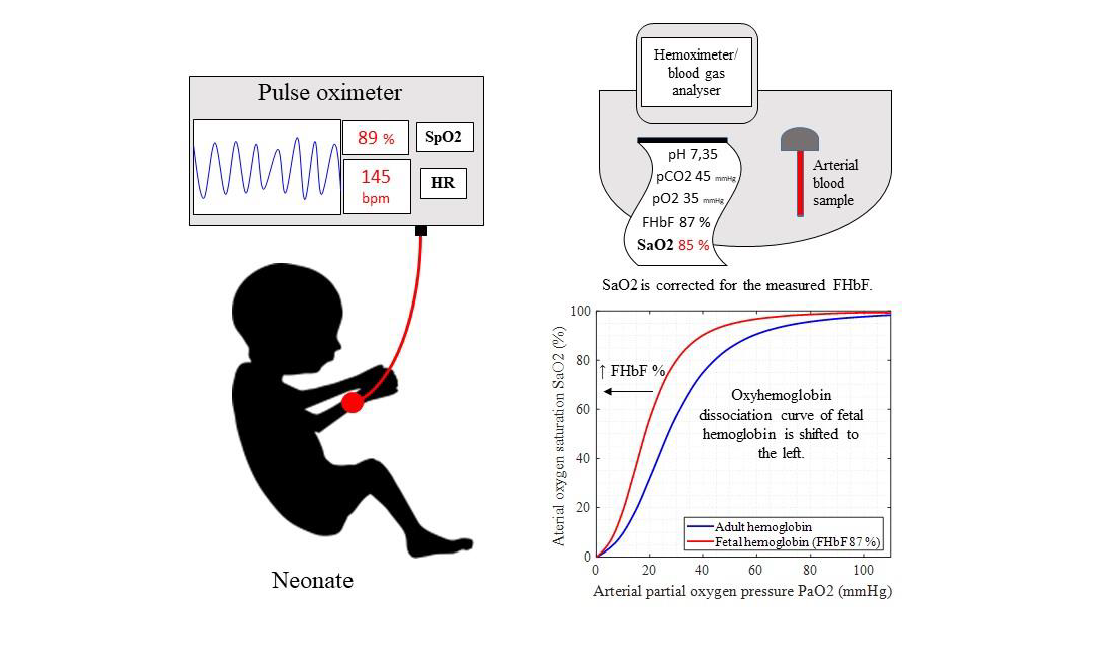 Children Free FullText Accuracy of Pulse Oximetry in the Presence