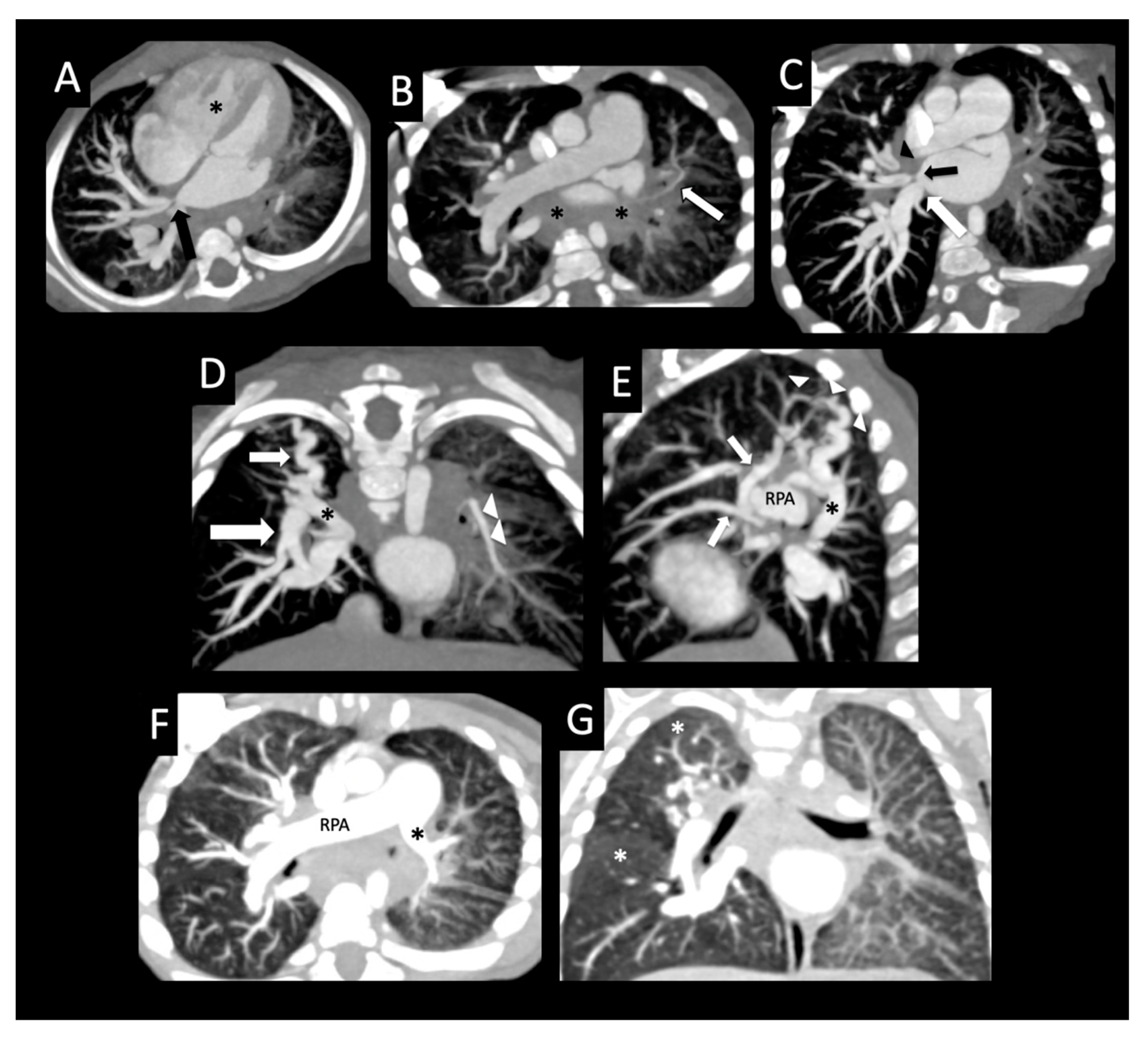 Children 08 00402 g007