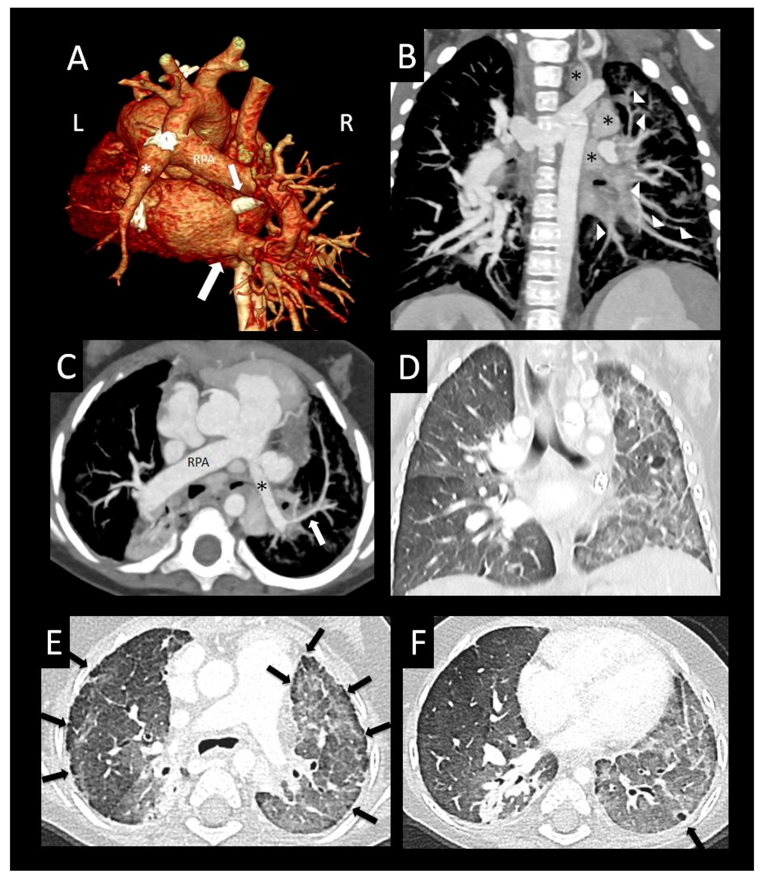 Children 08 00402 g009