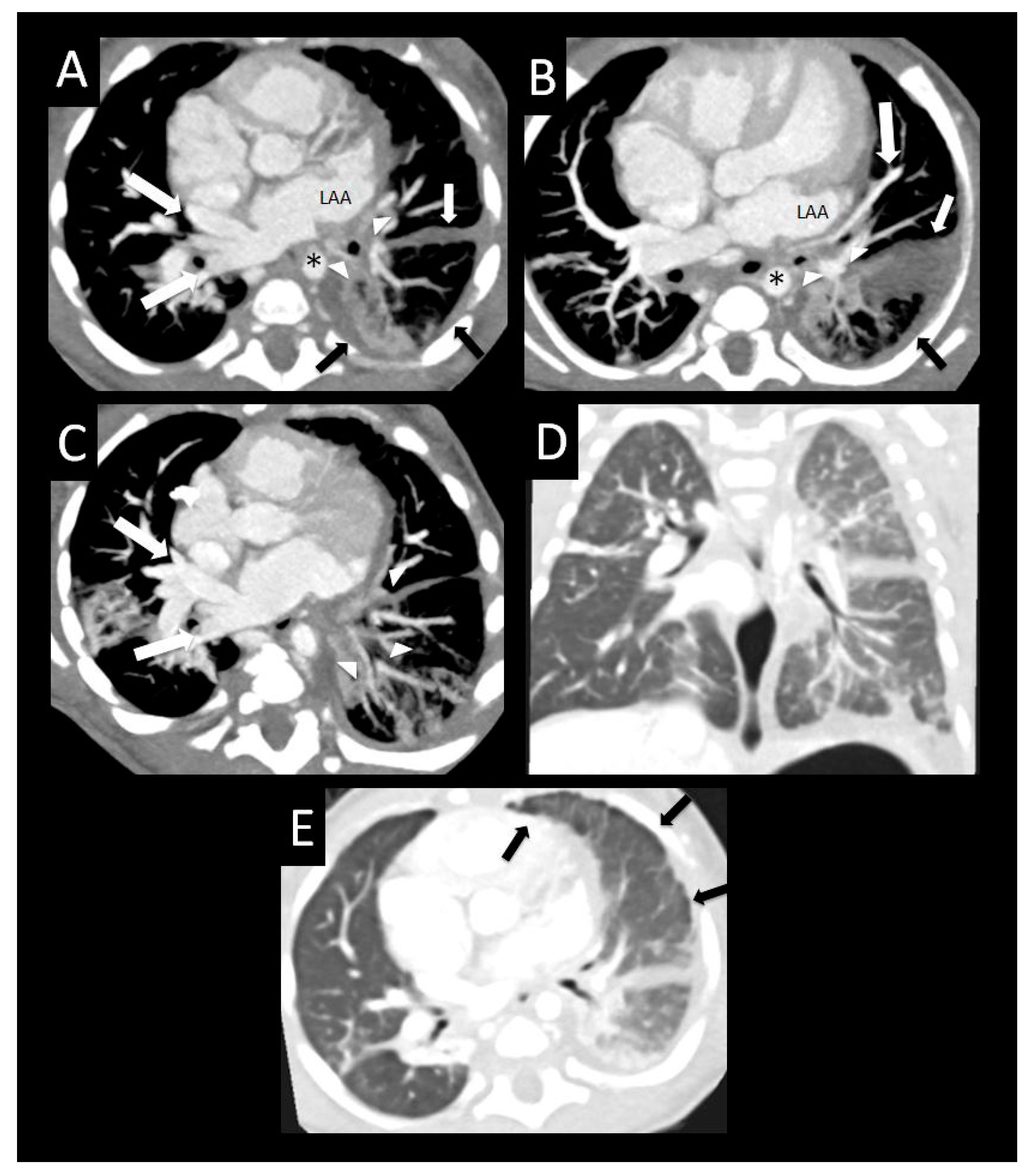 Children 08 00402 g011