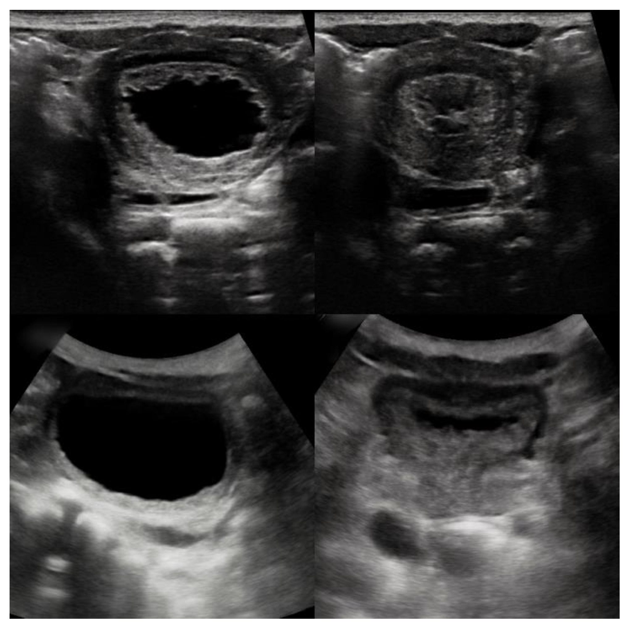 Children 08 00408 g004