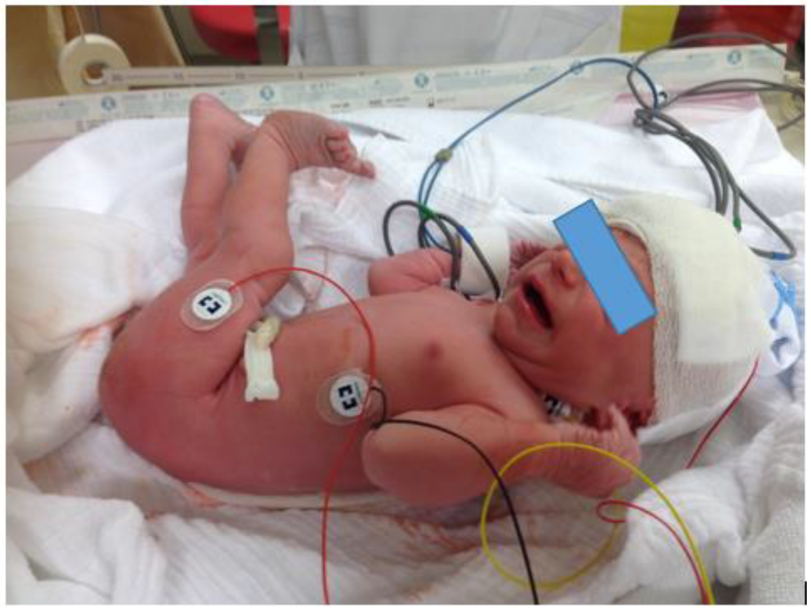 Children 08 00439 g001