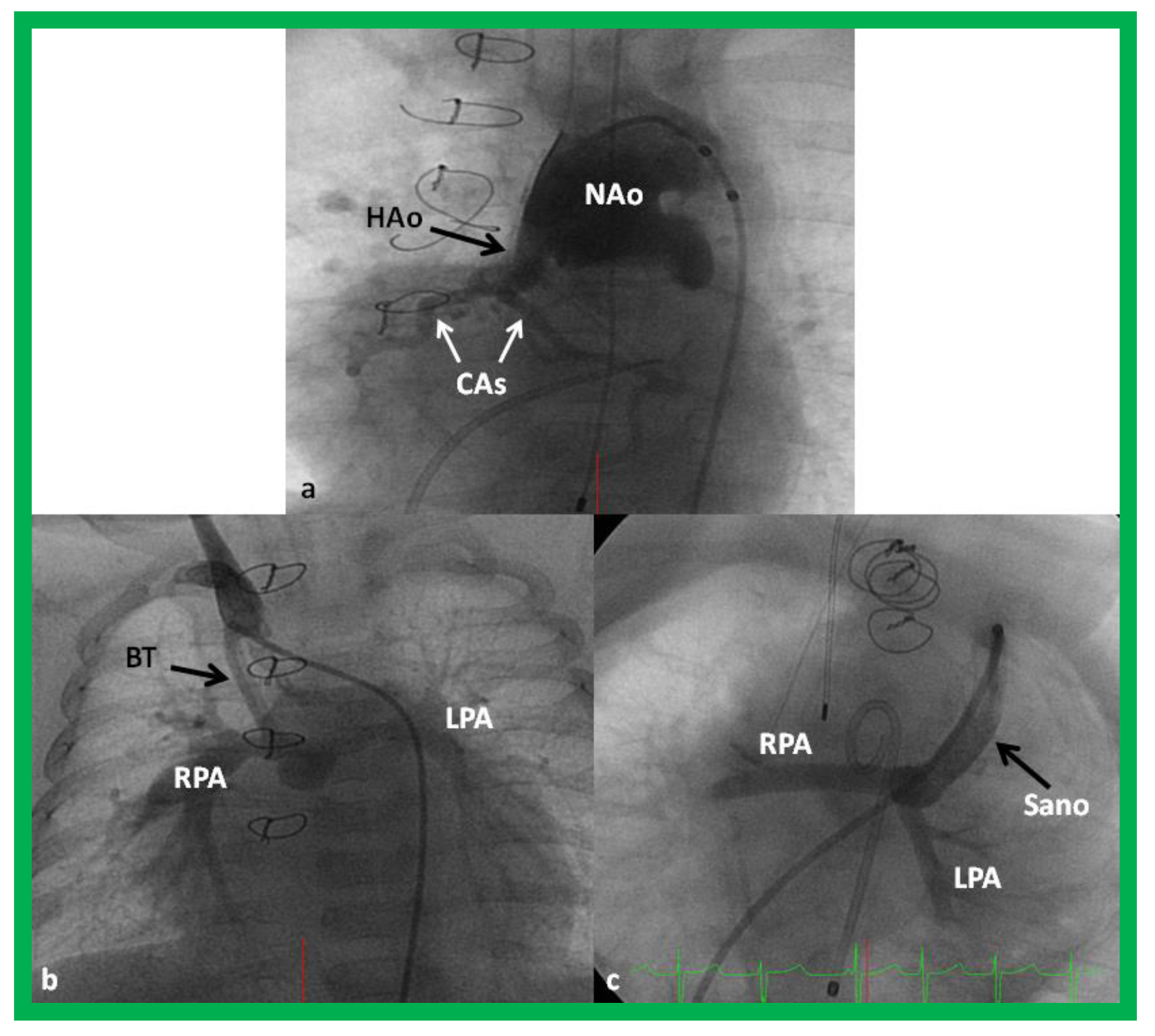 Children 08 00441 g011