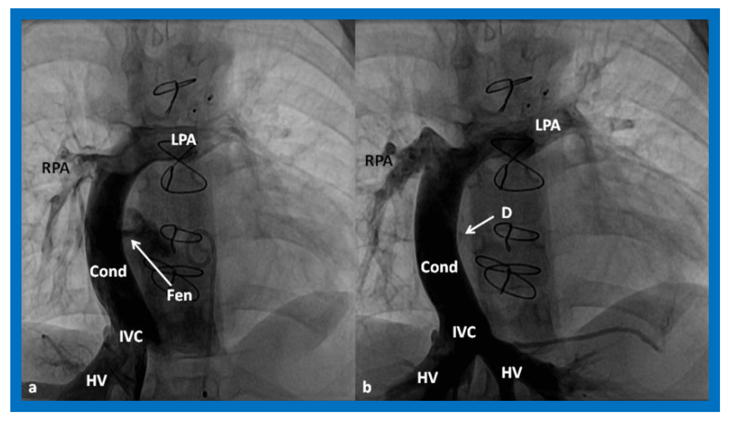 Children 08 00441 g017