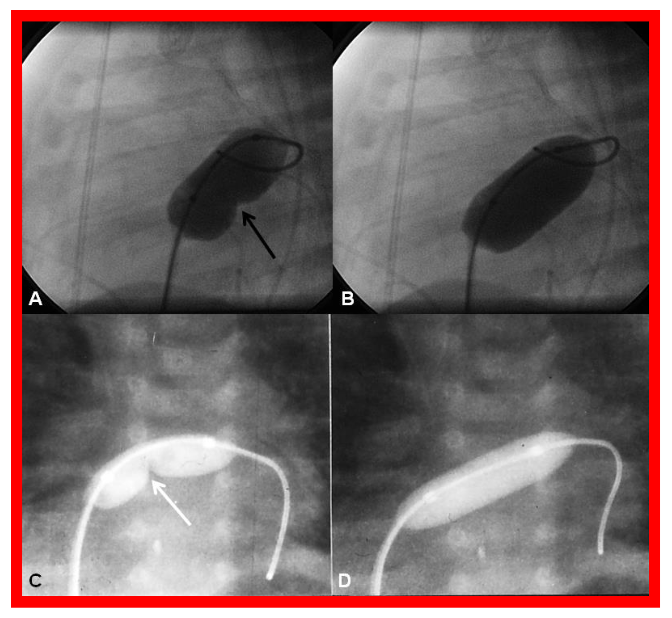 Children 08 00441 g018