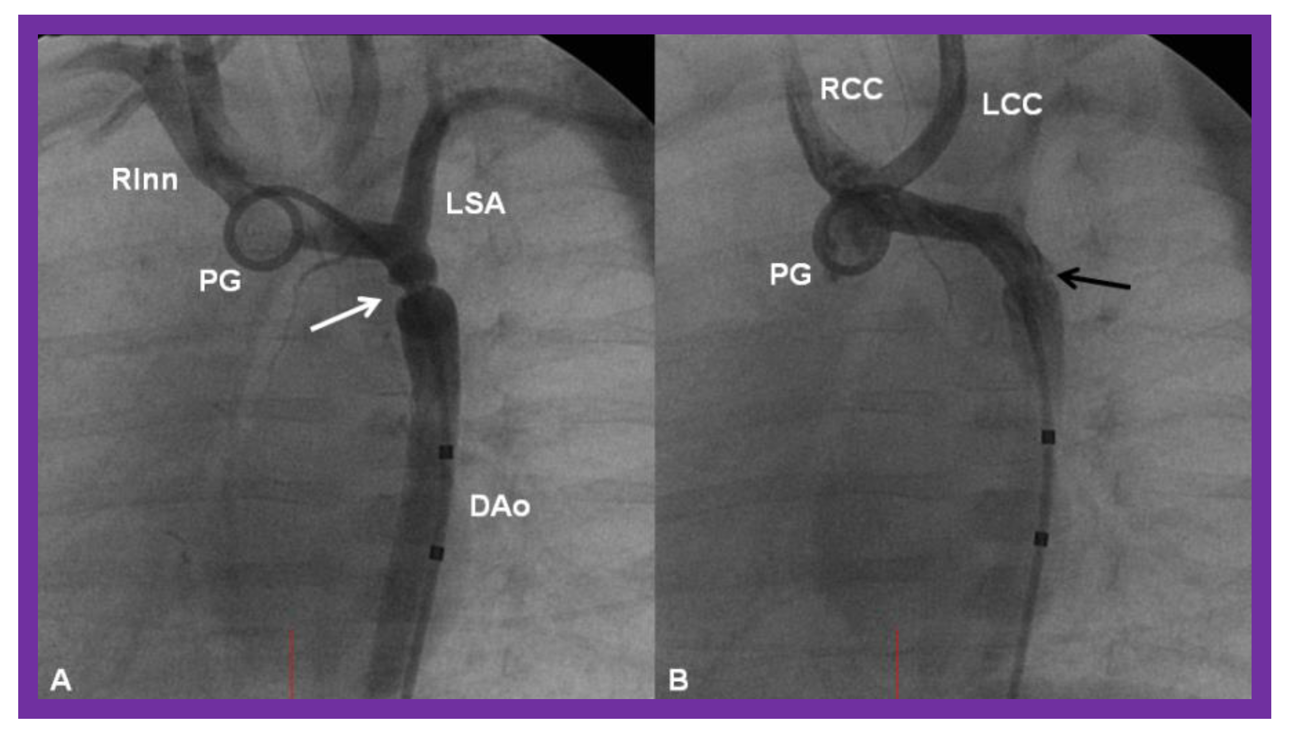 Children 08 00441 g024