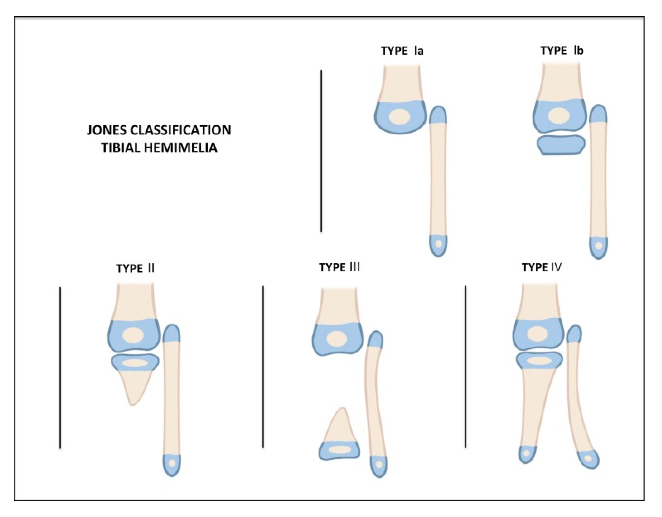 QUAIS CLUB USAR ? TIBIA TUTORIAL COMPLETO 