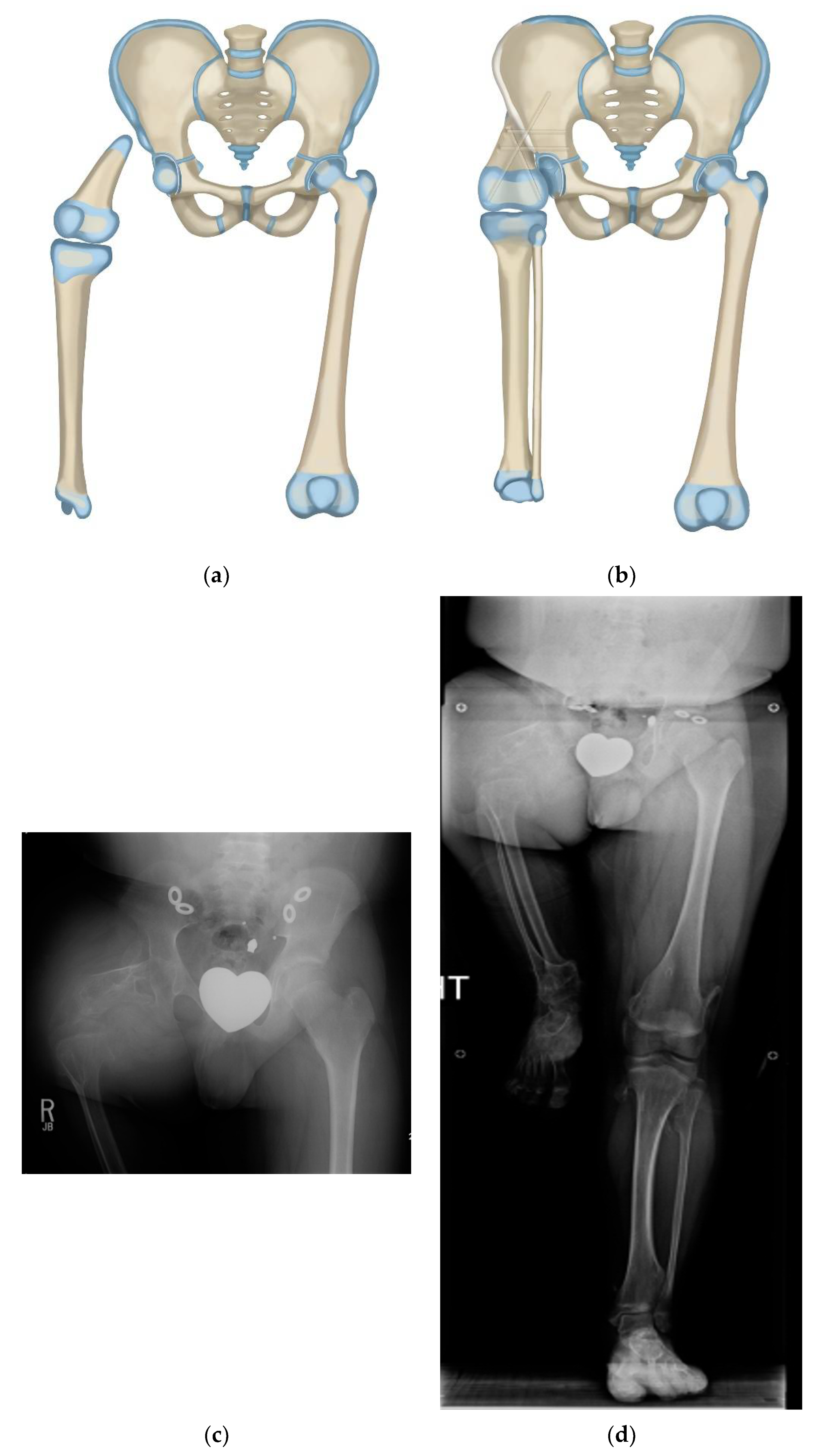 Children 08 00462 g002a