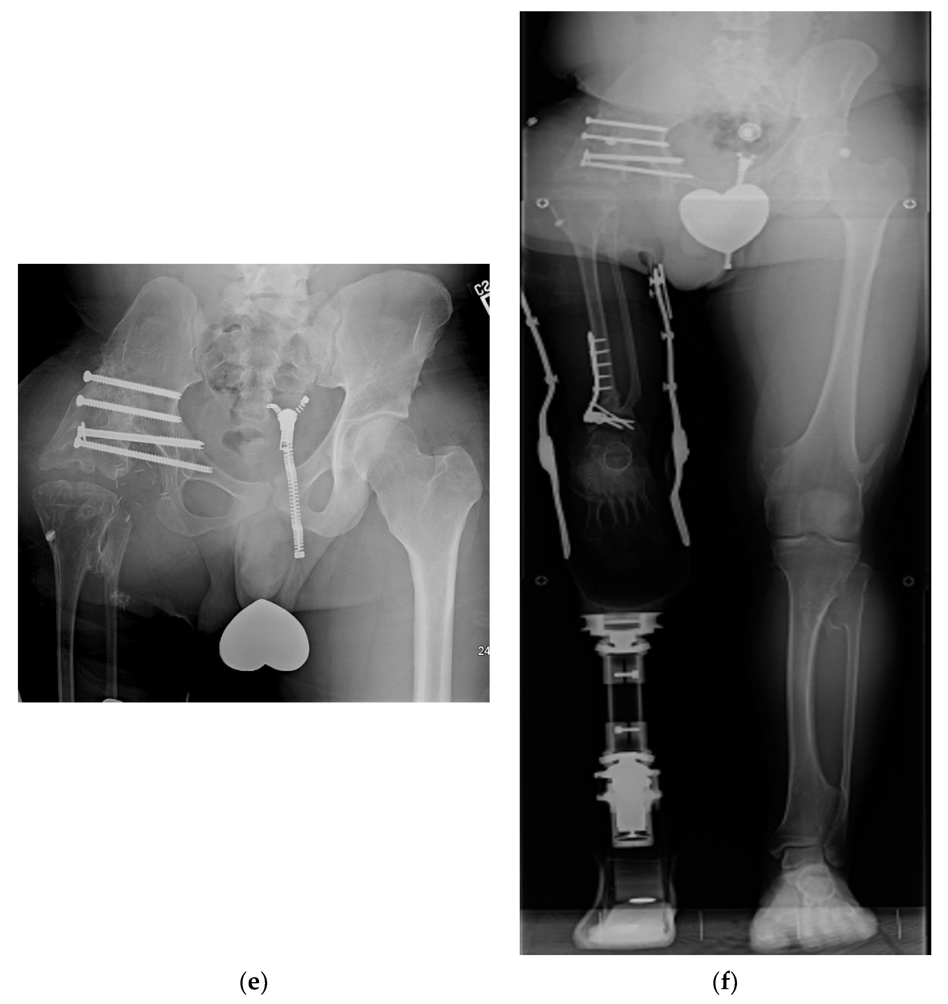 Children 08 00462 g002b