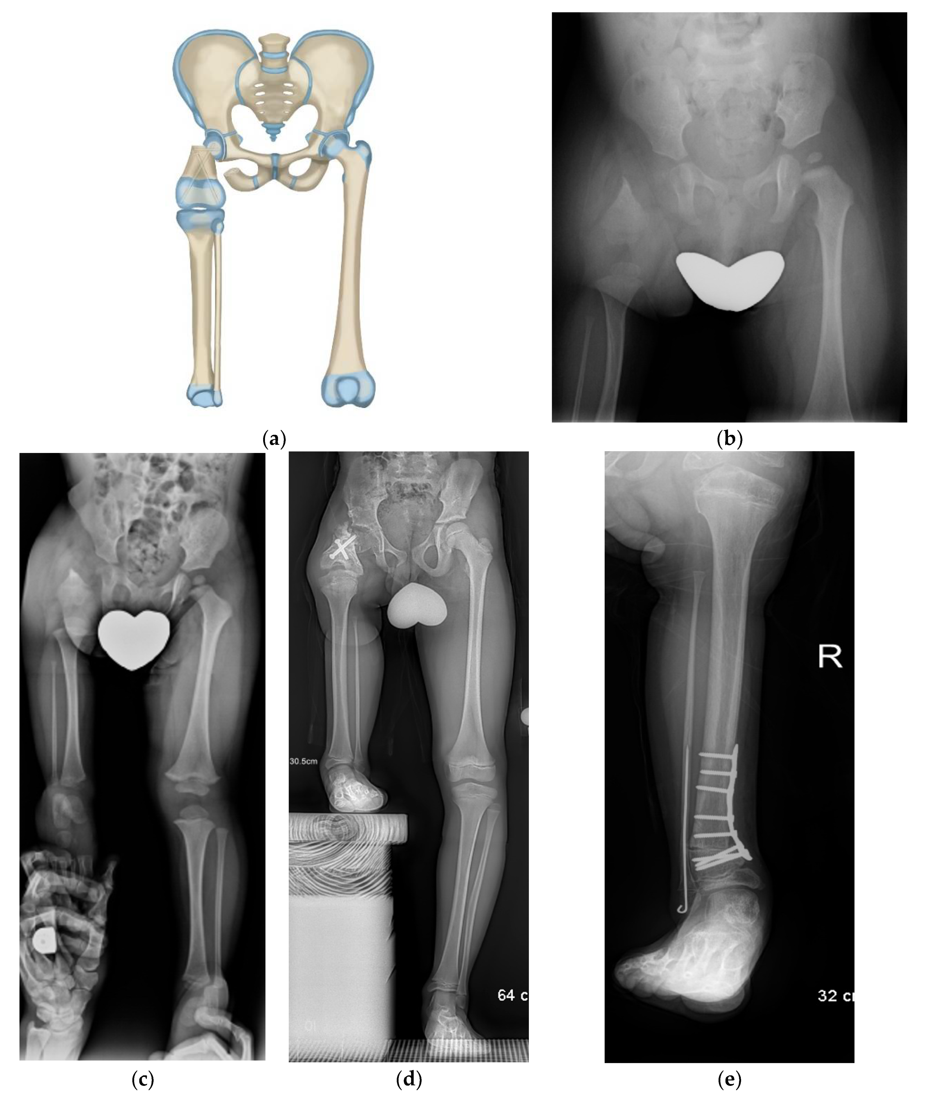 Children 08 00462 g004