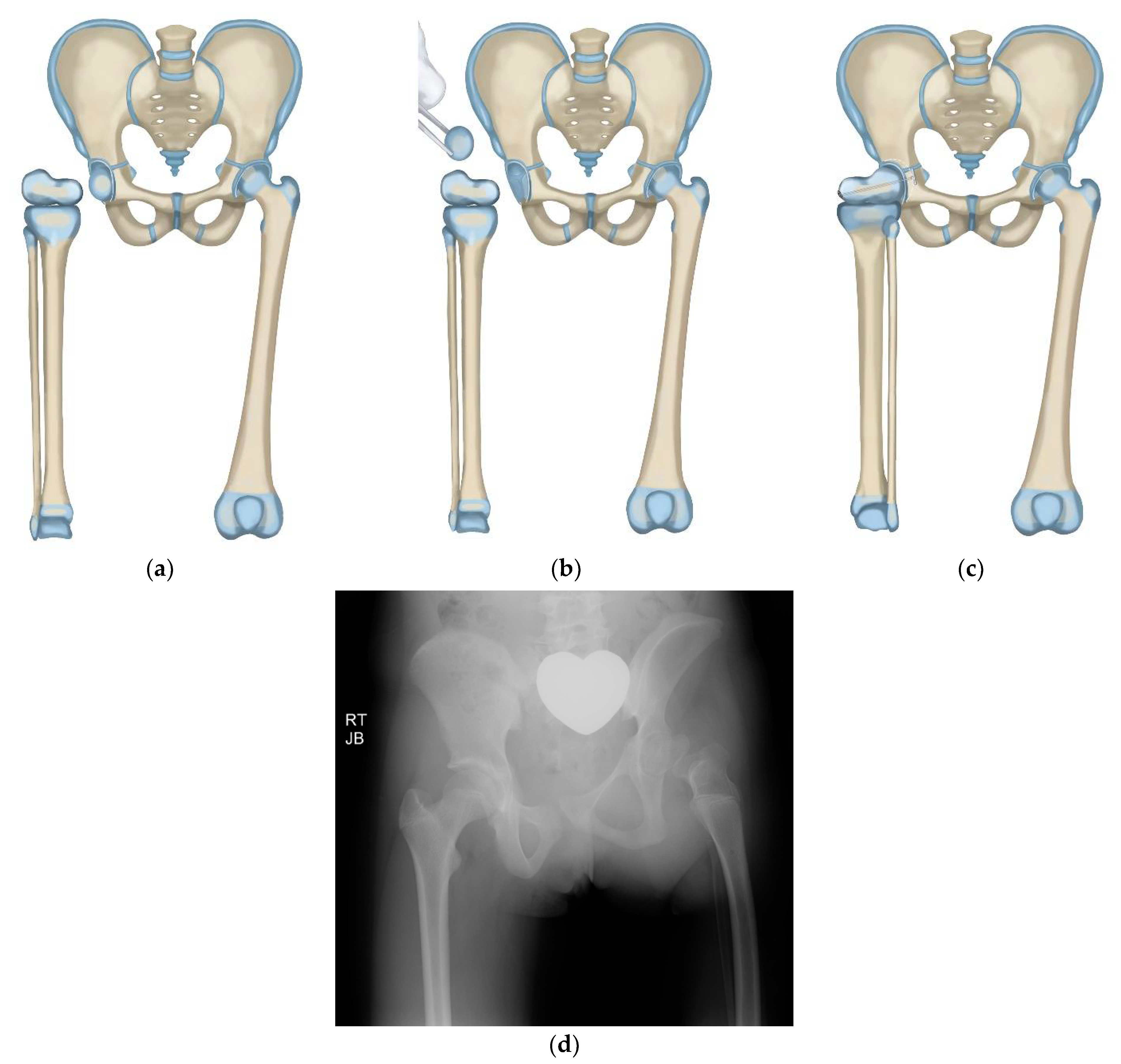 Children 08 00462 g005a