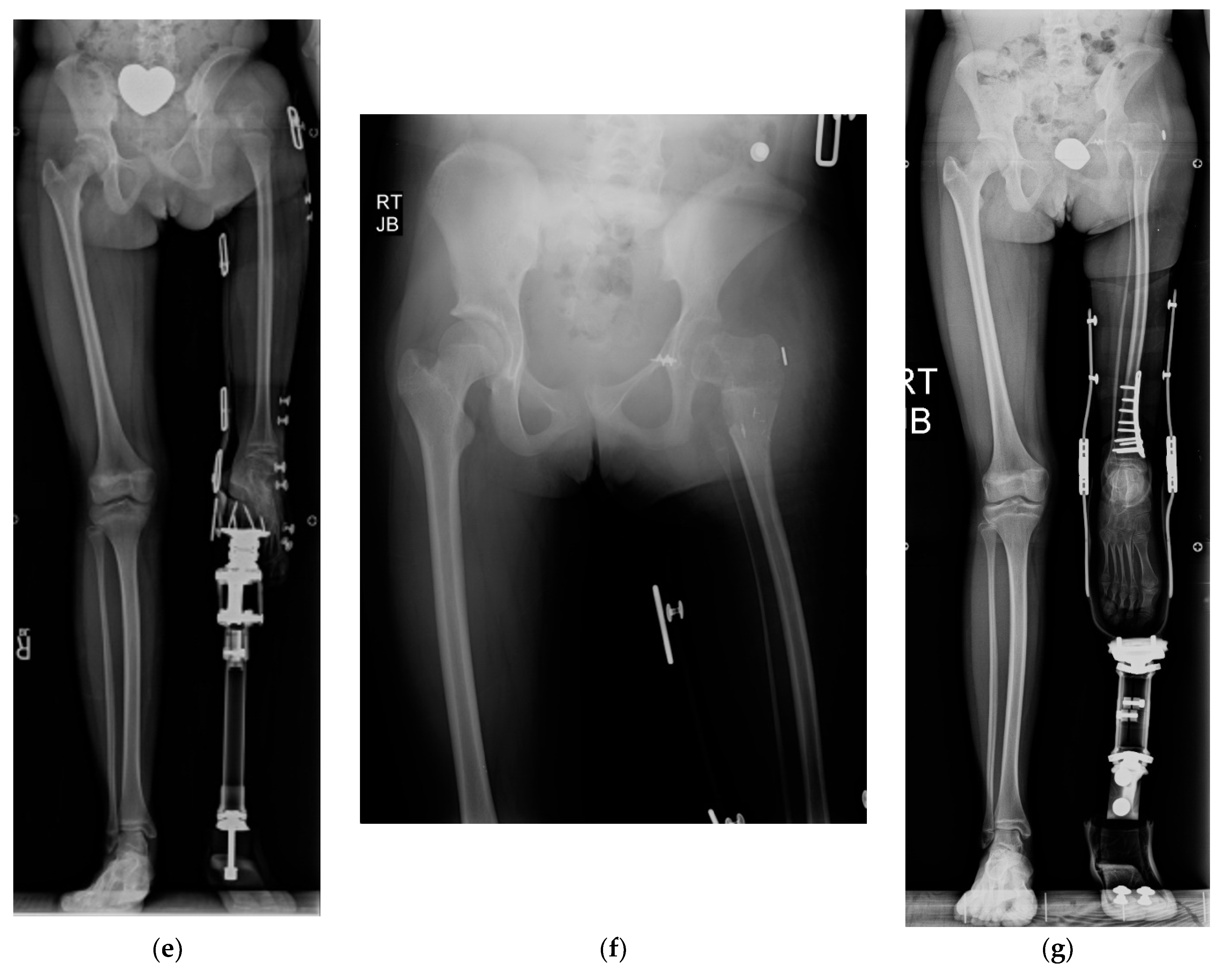 Children 08 00462 g005b