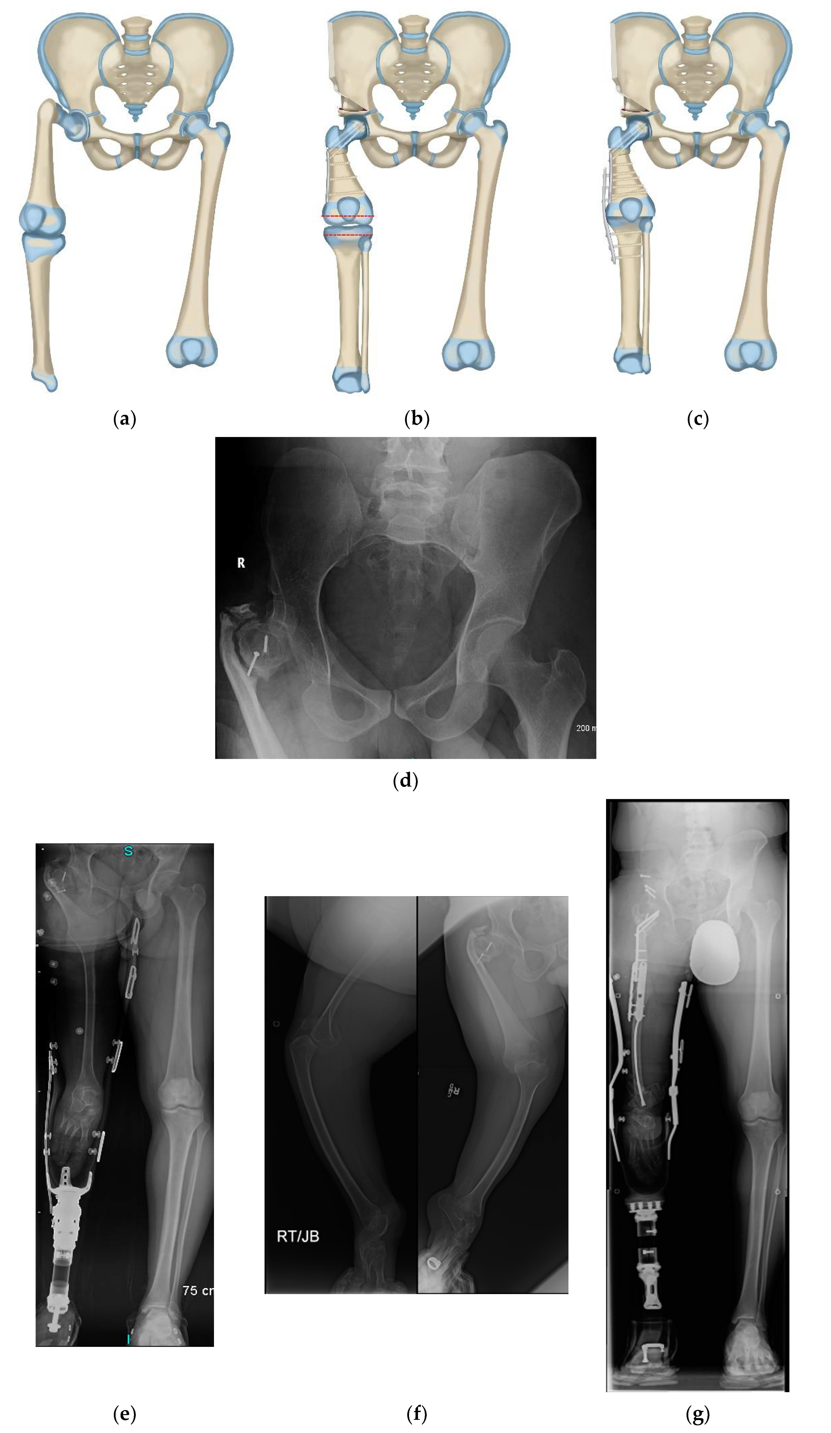 Children 08 00462 g006