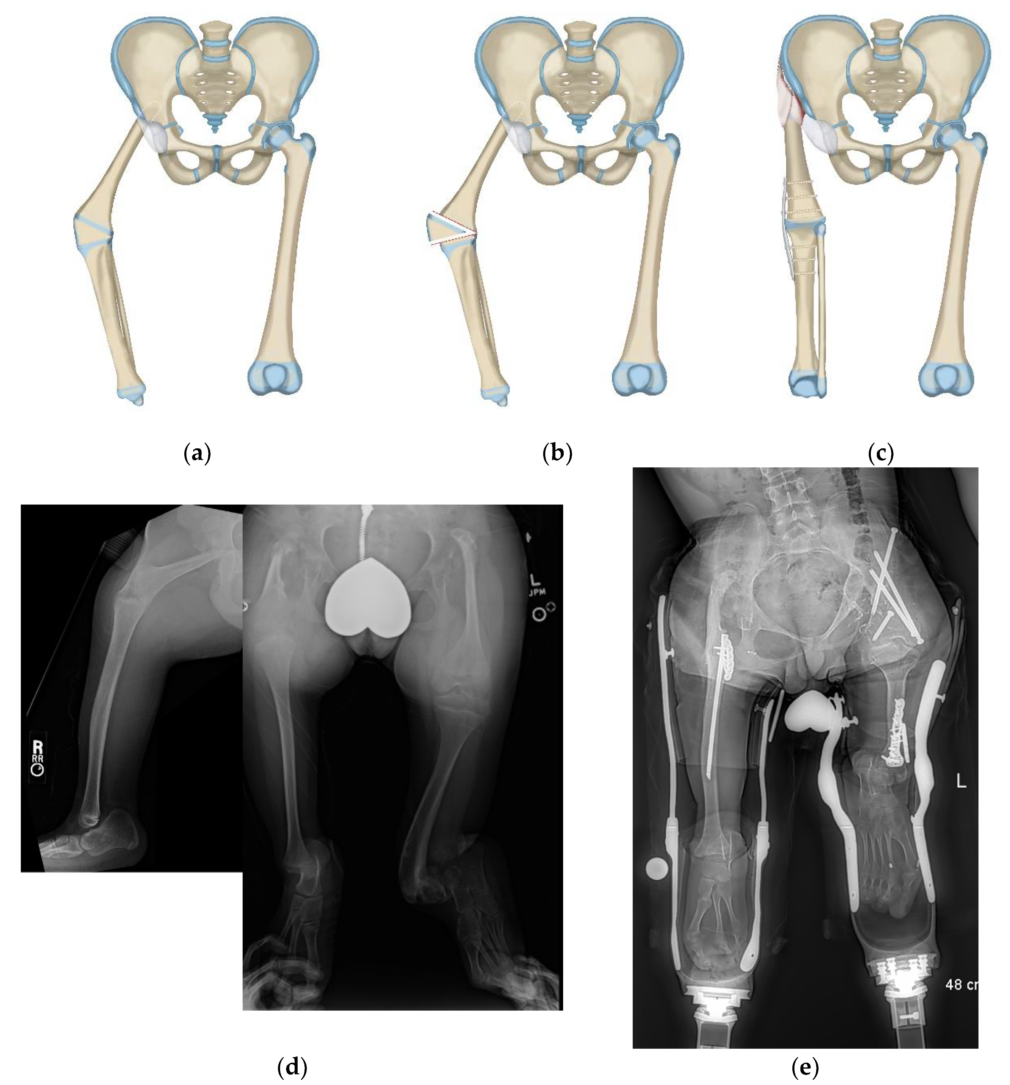 Children 08 00462 g007