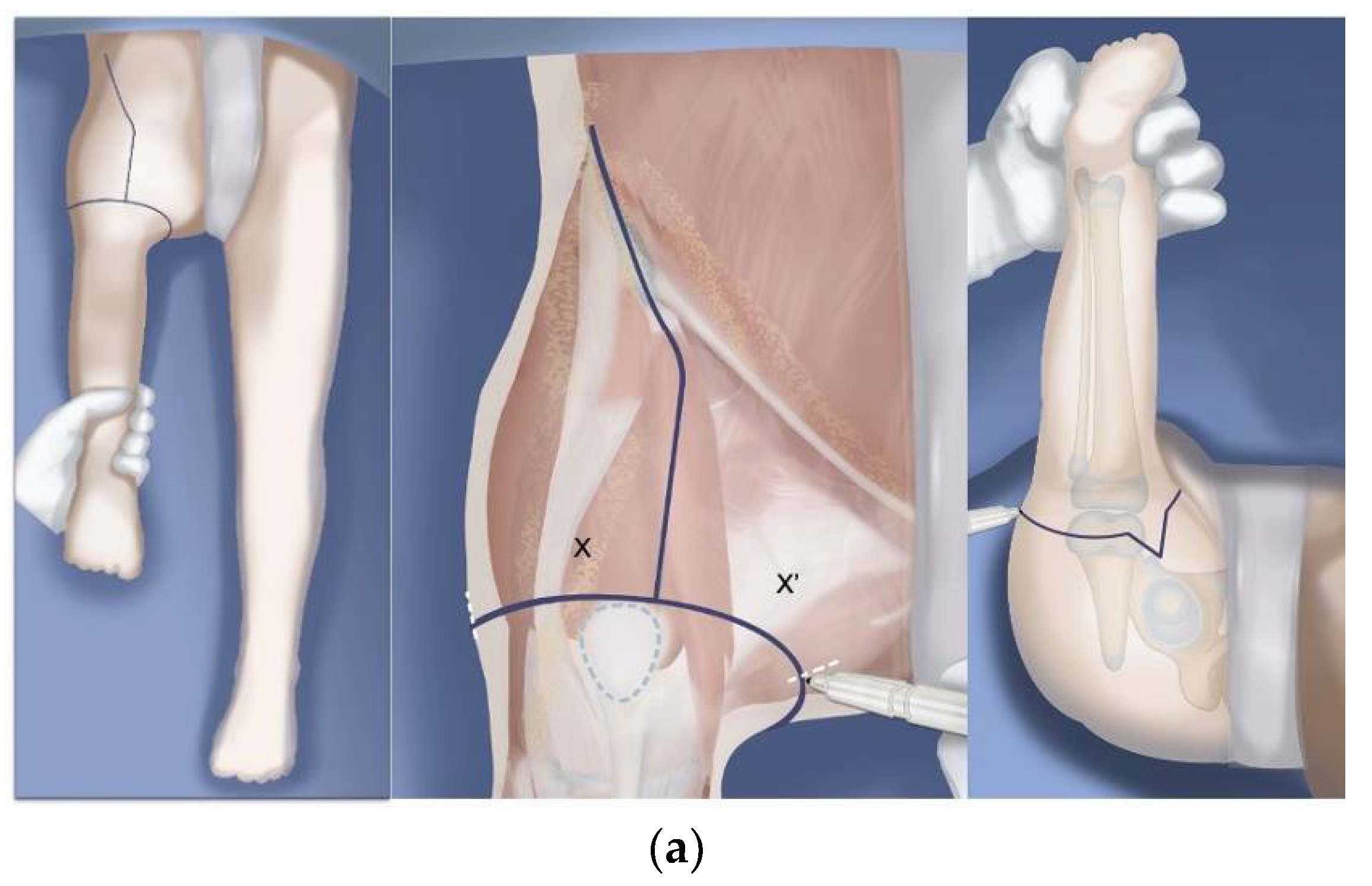 Children 08 00462 g008a