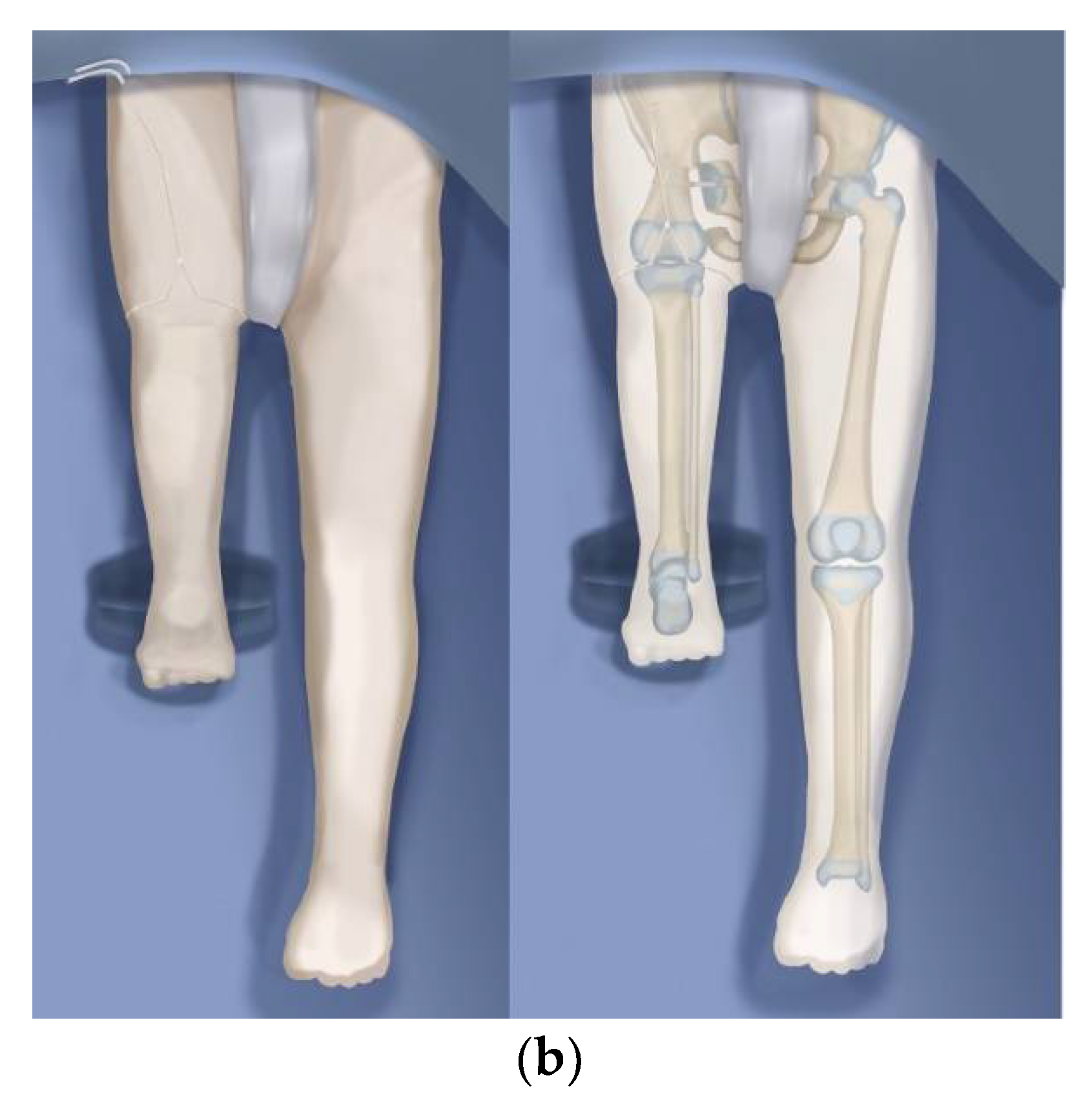 Children 08 00462 g008b