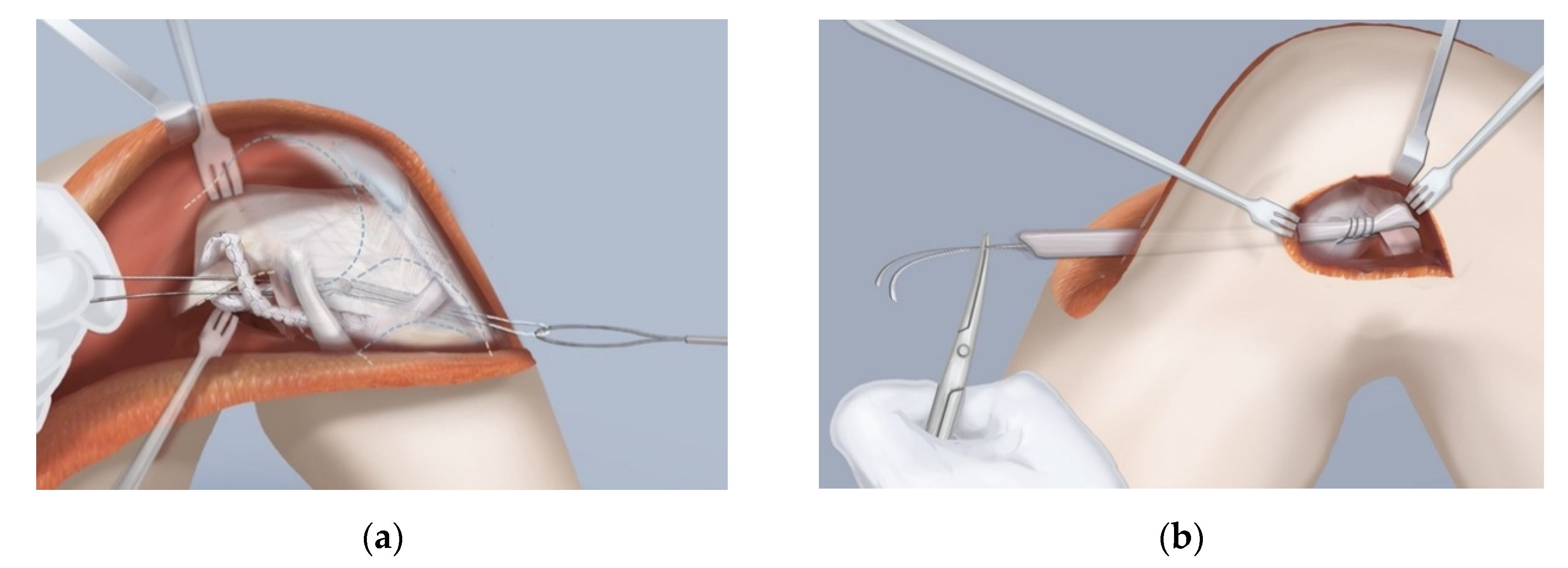 Children 08 00467 g008 Children 08 00467 g008