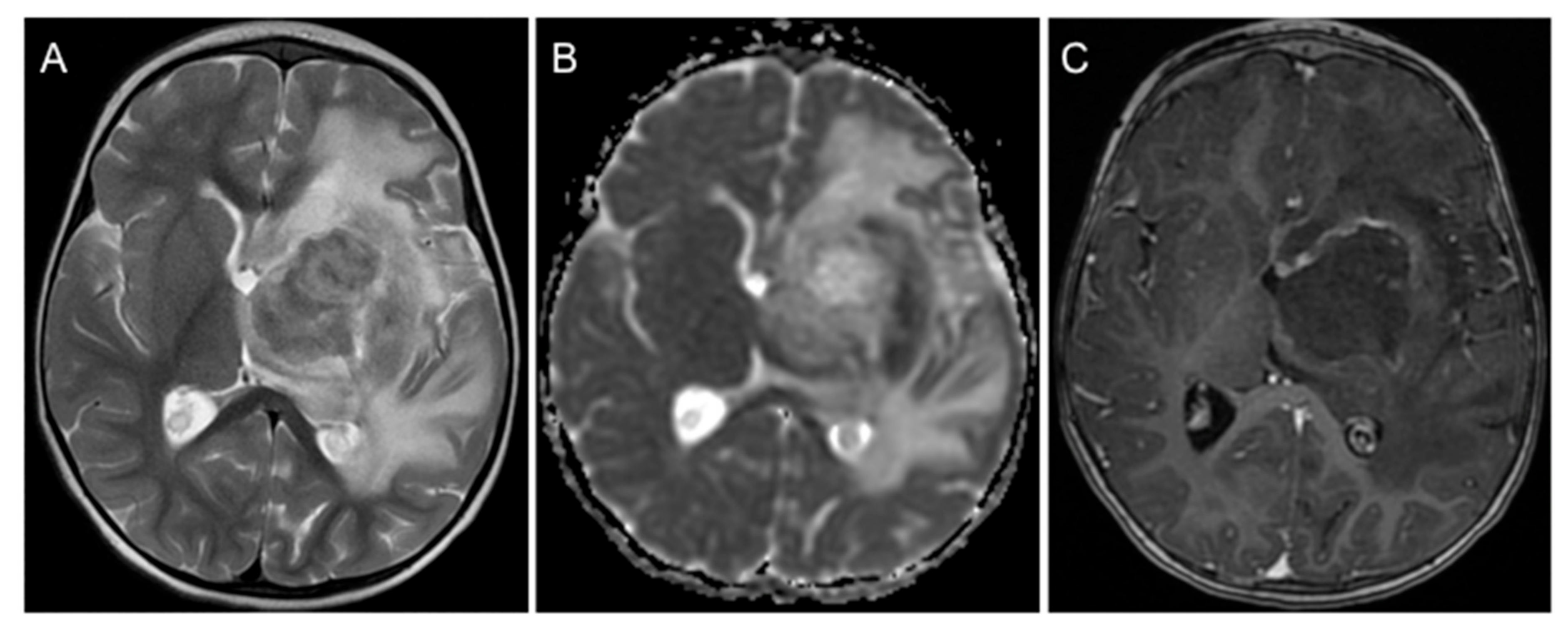 Children 08 00469 g001