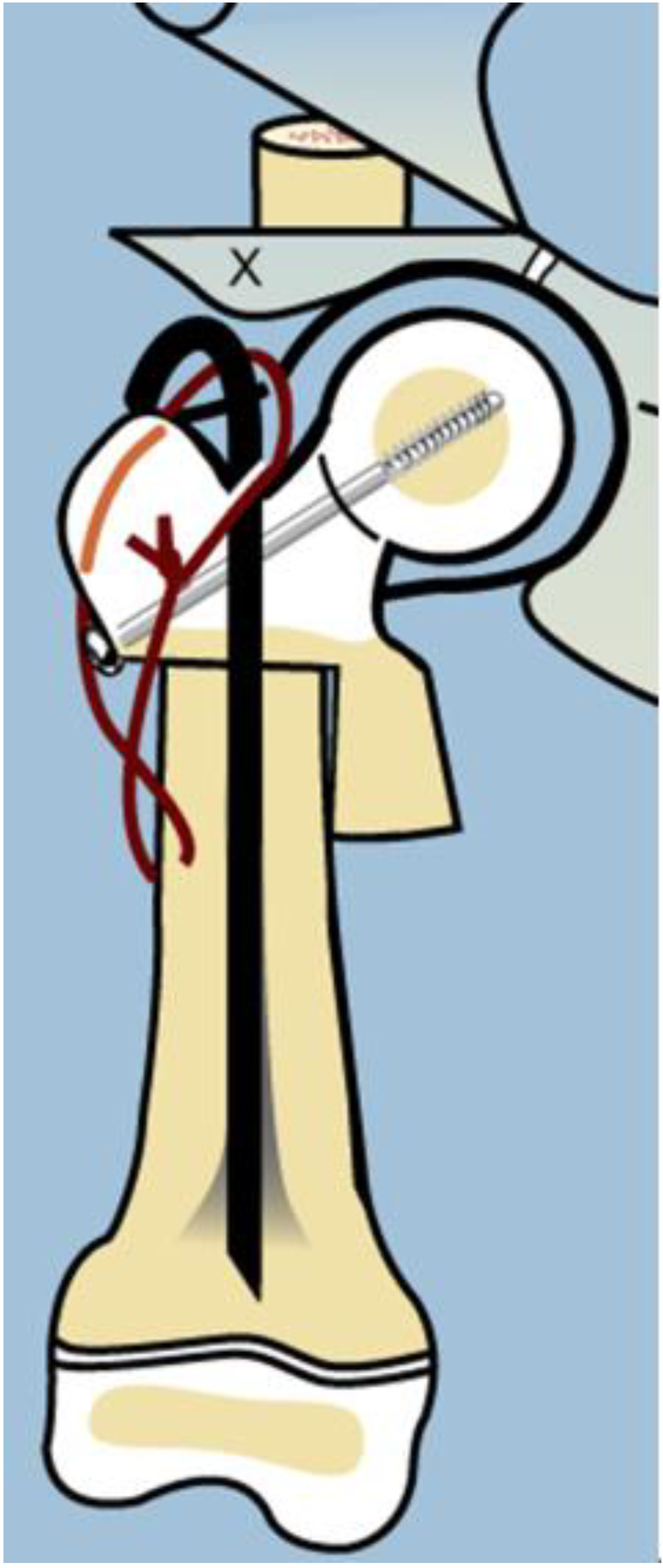 Children 08 00495 g003