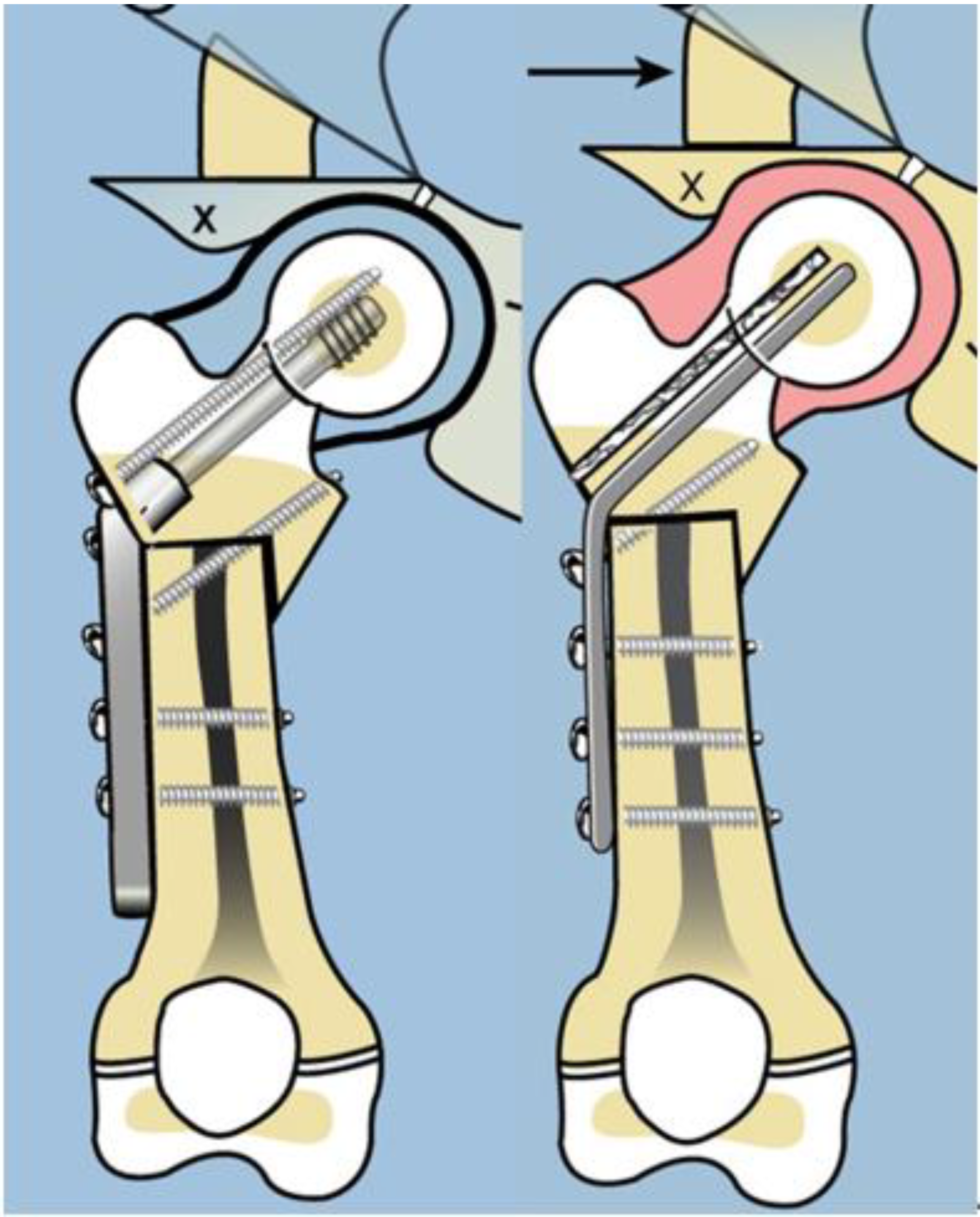 Children 08 00495 g004