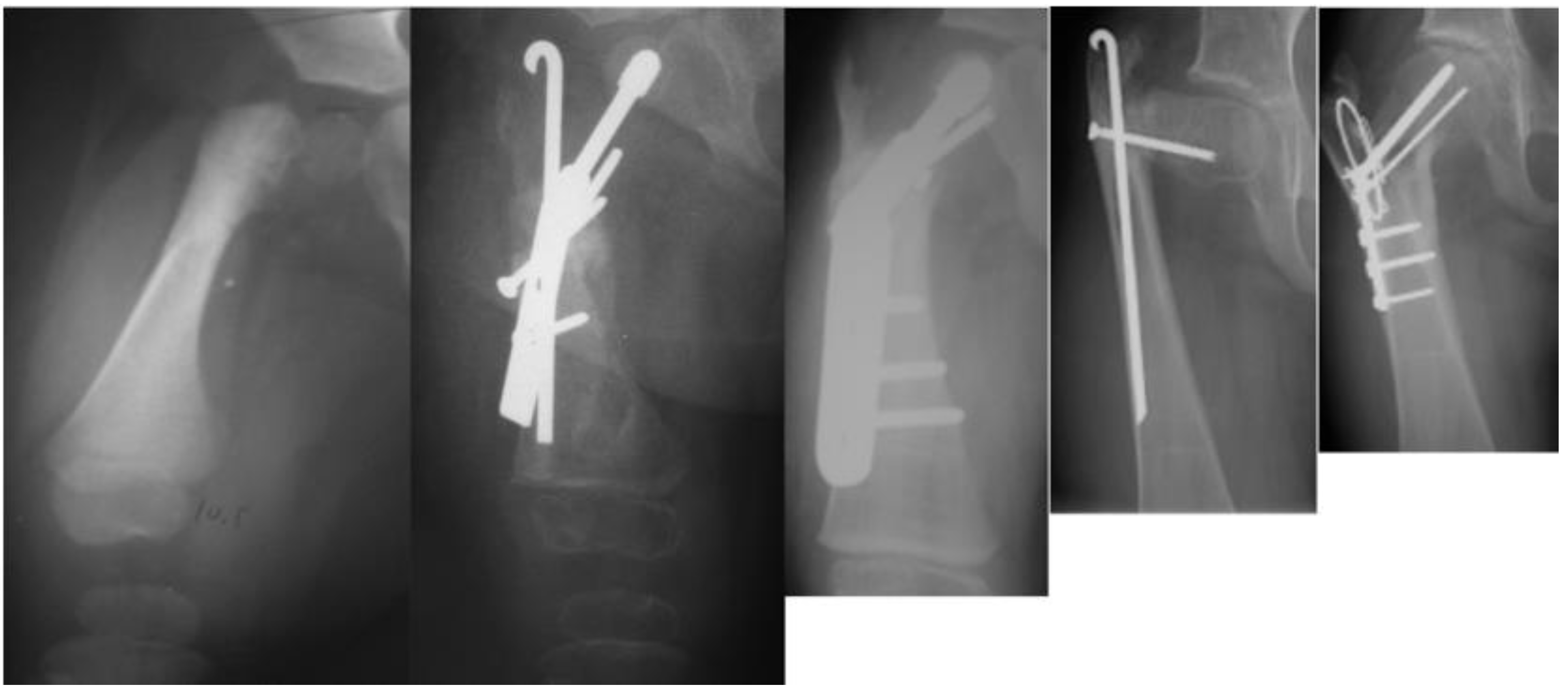 Children 08 00495 g005