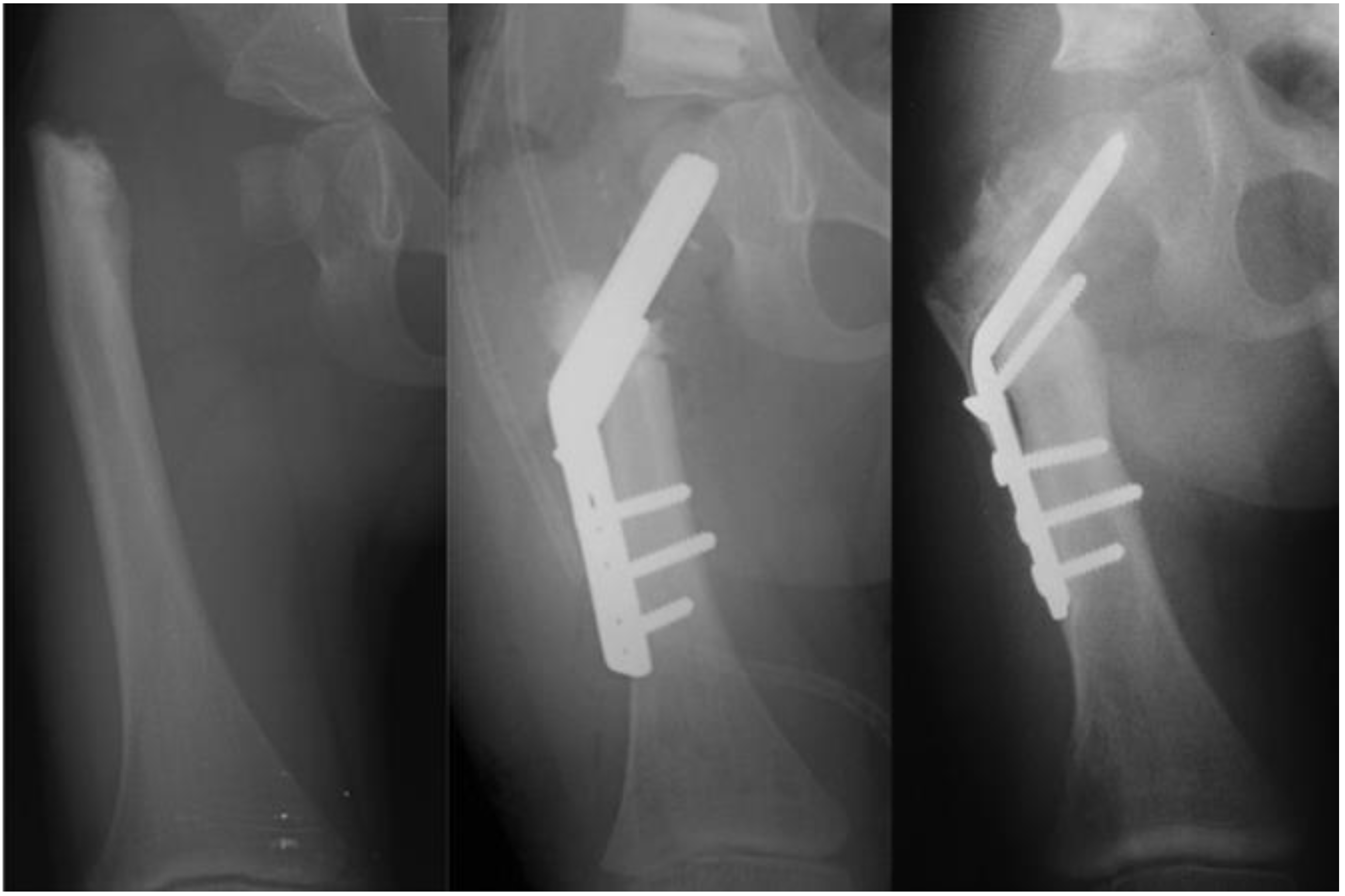 Children 08 00495 g006