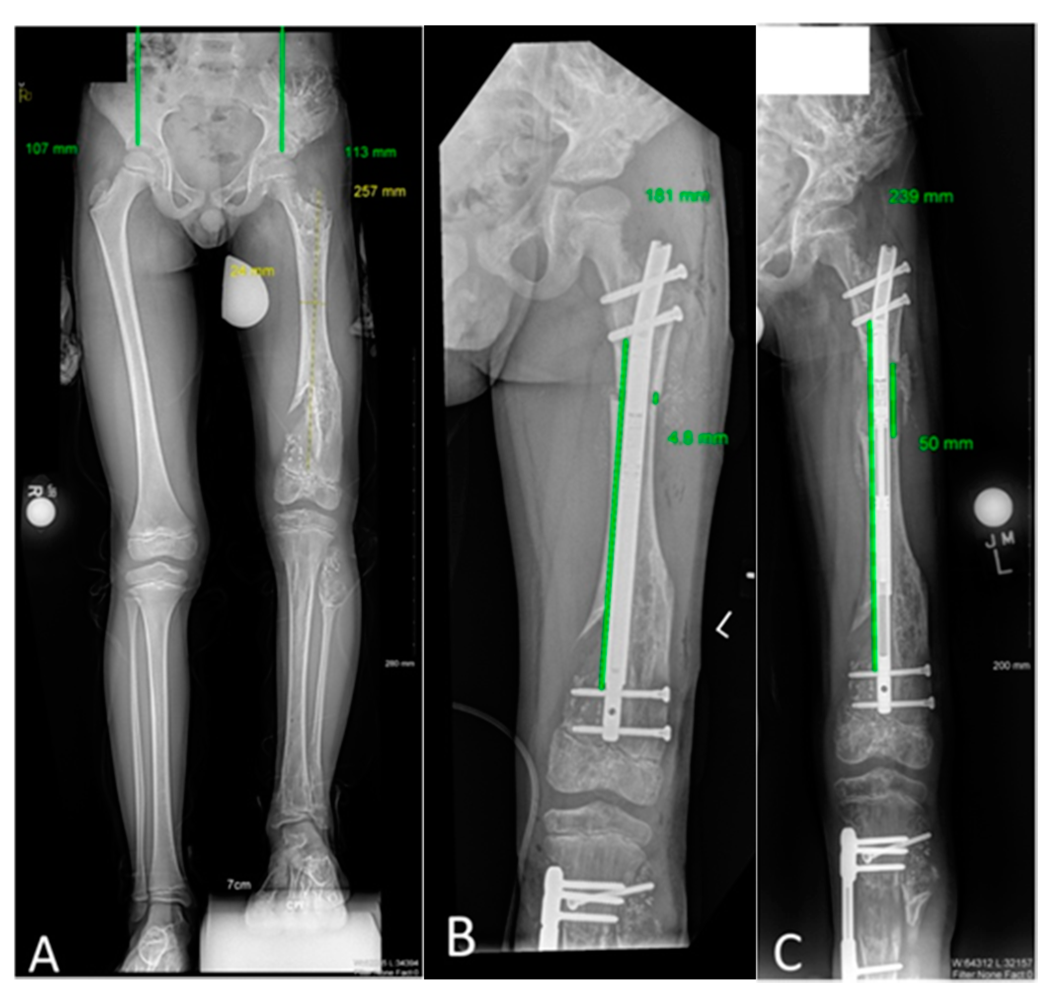 Children 08 00502 g001