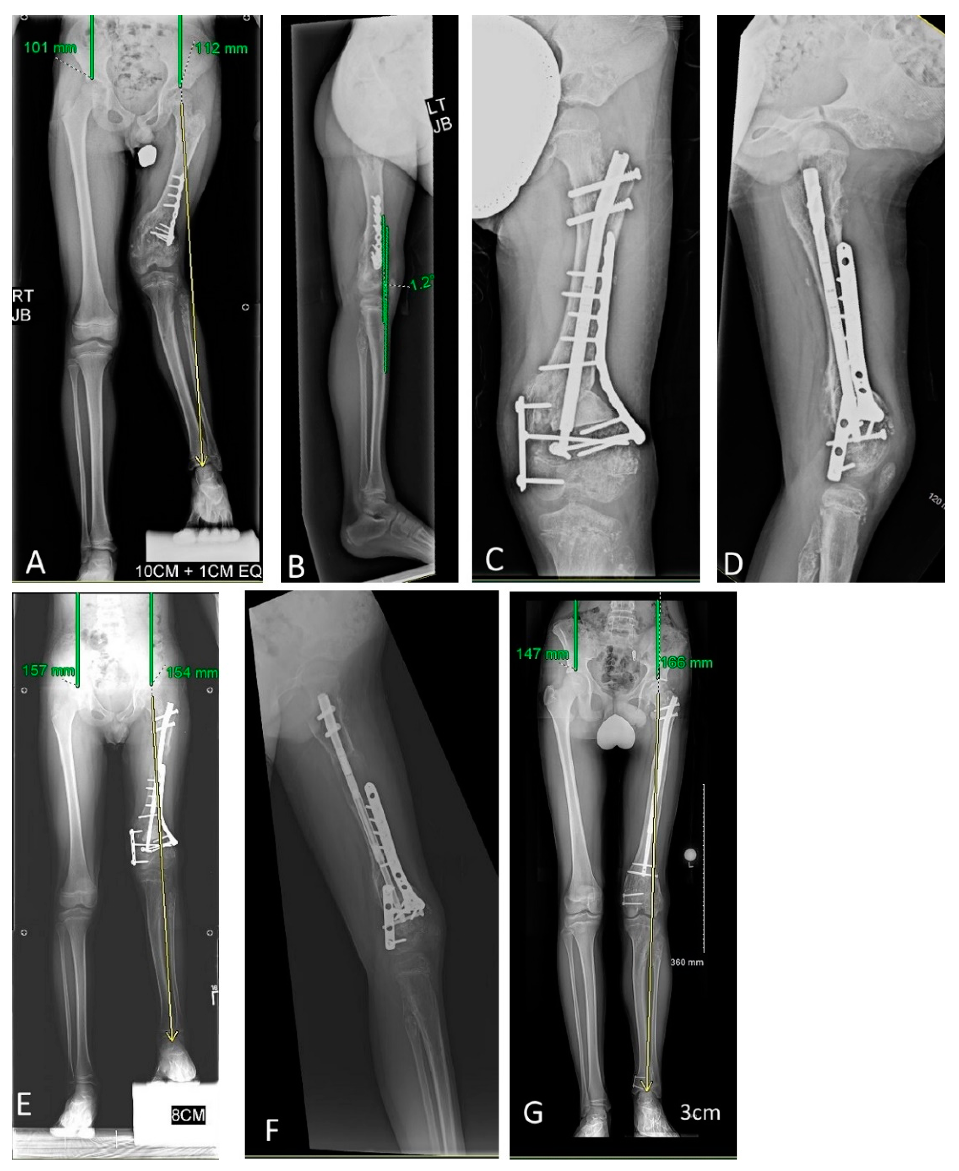 Children 08 00502 g003