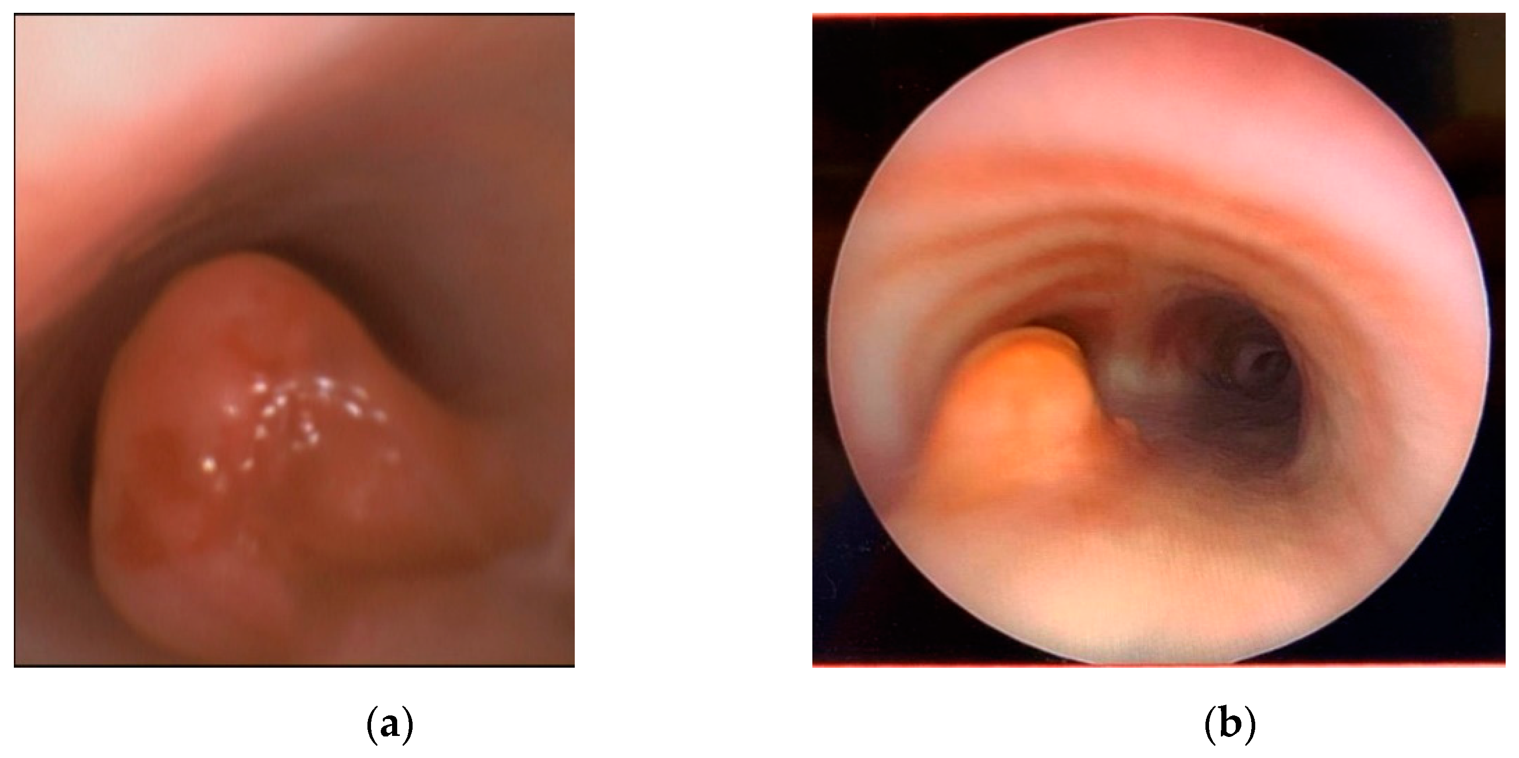 Children 08 00505 g002