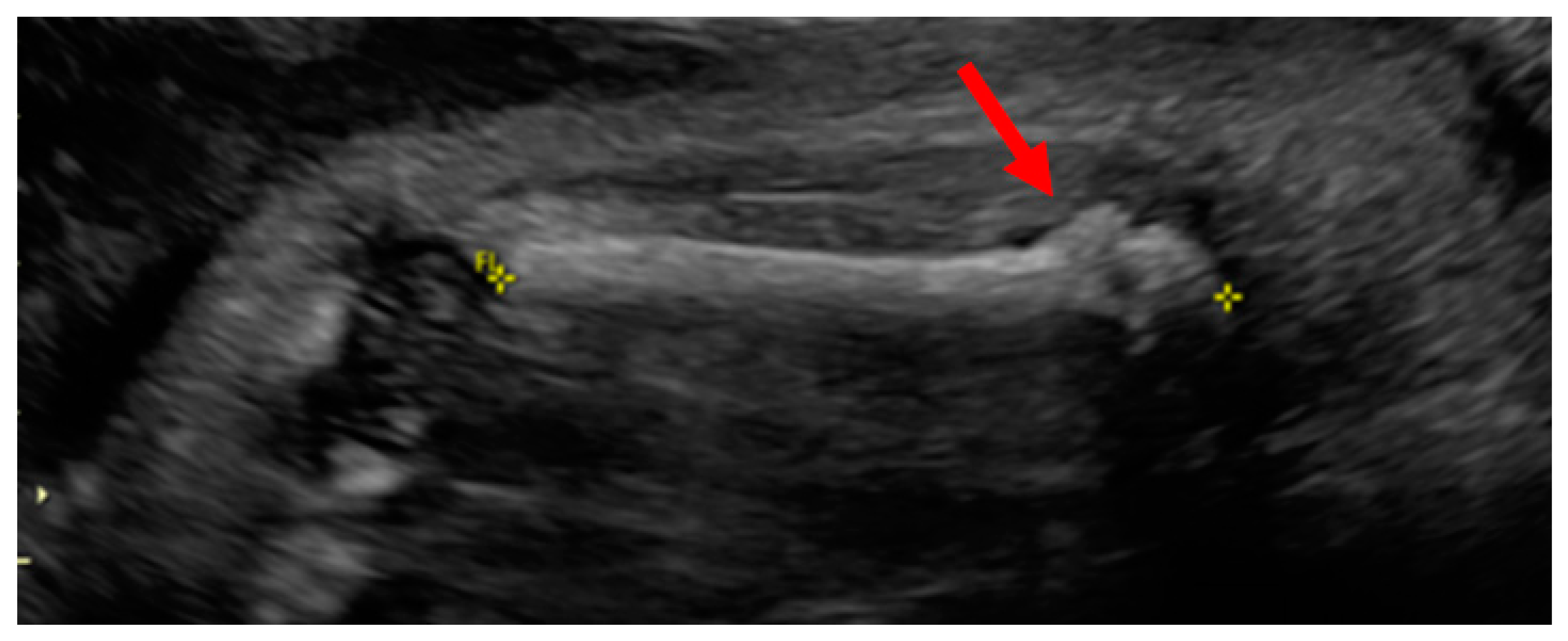 Children 08 00512 g003