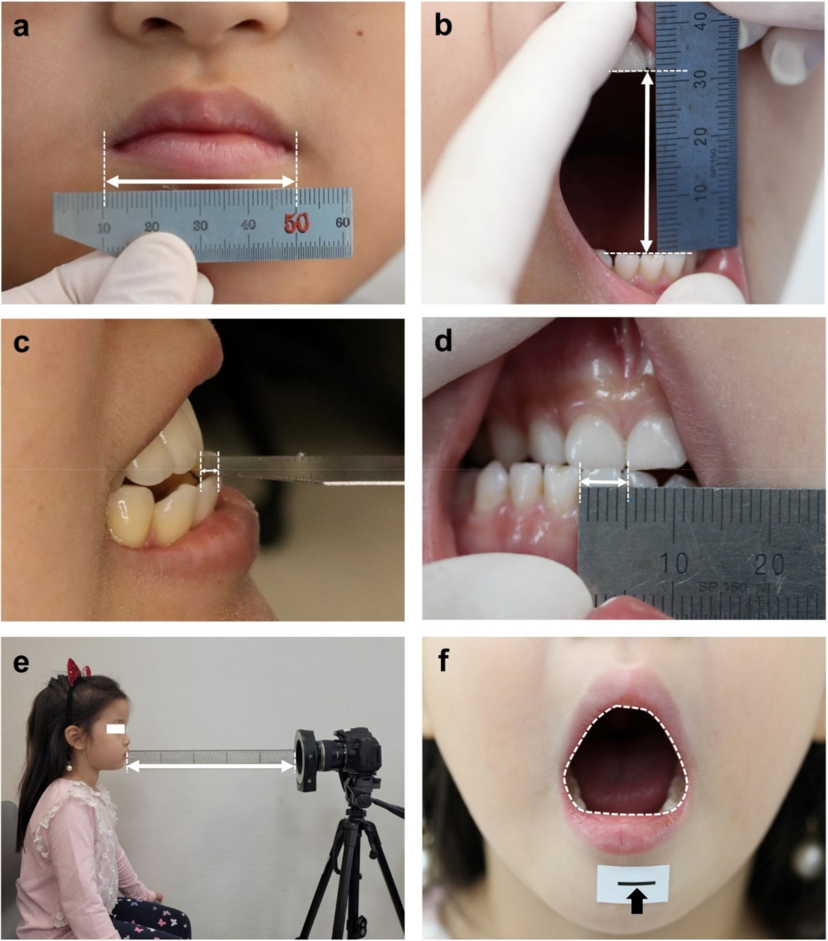 Children 08 00515 g002 Children 08 00515 g002