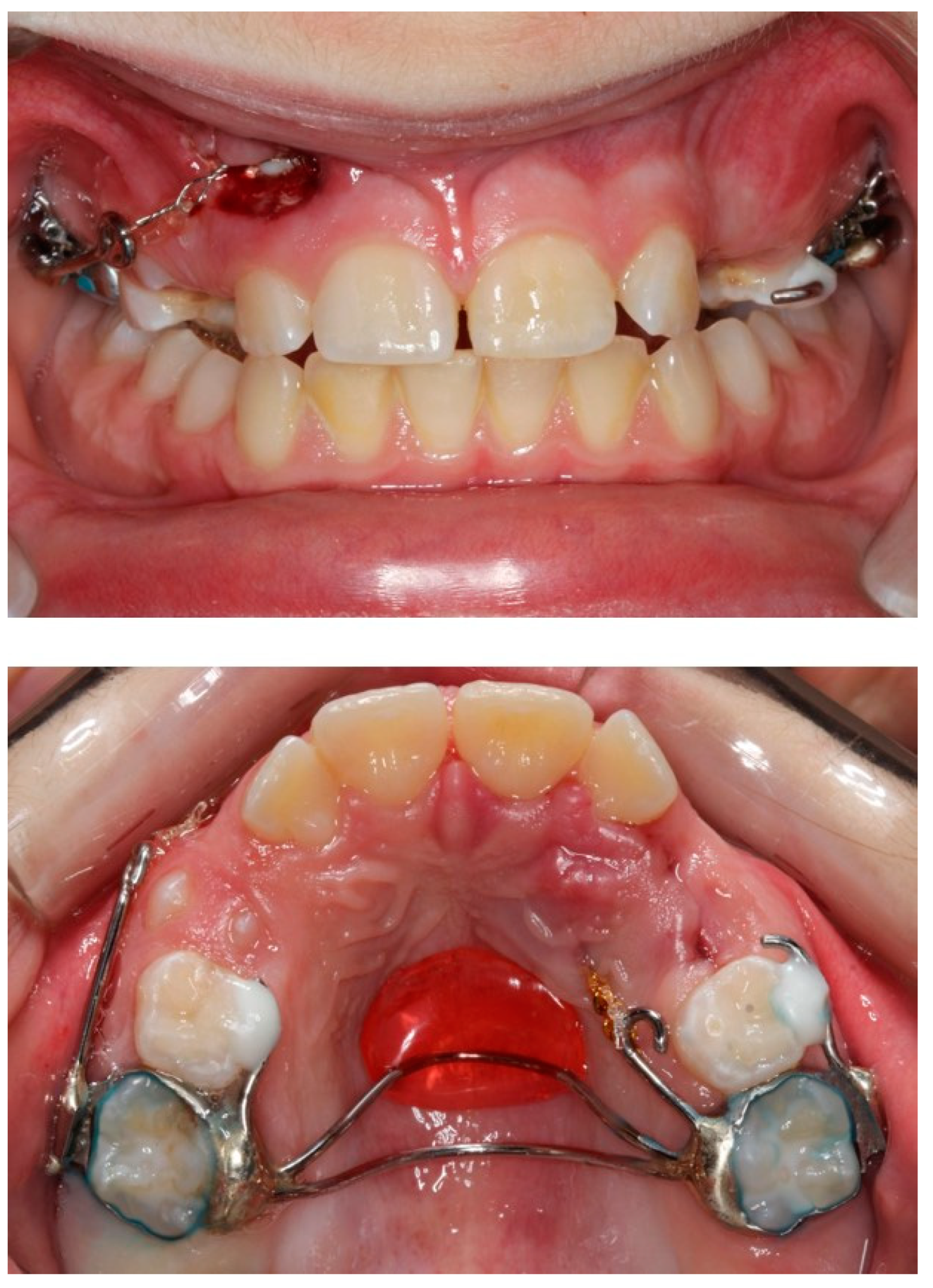 Children 08 00519 g006 Children 08 00519 g006