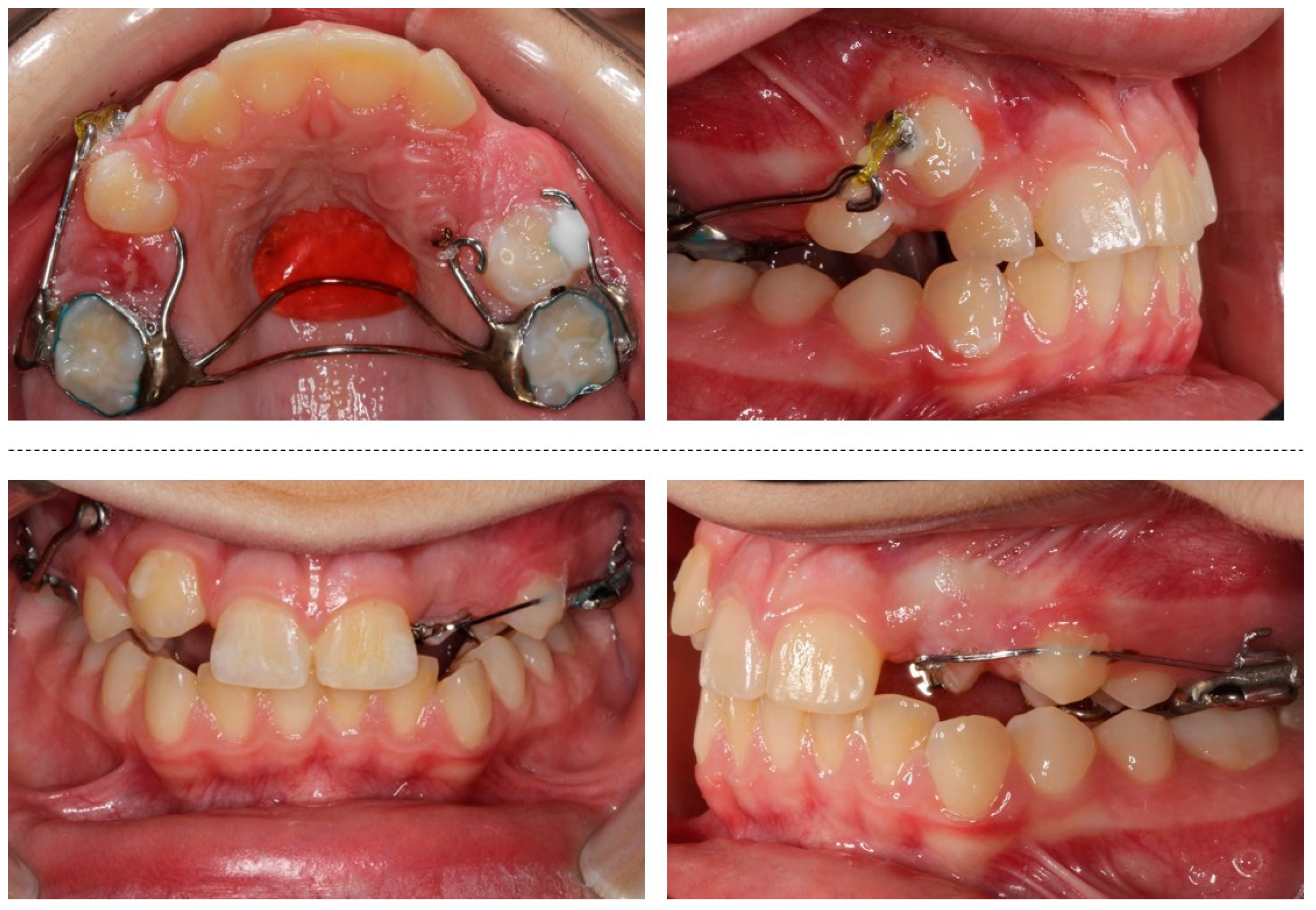 Children 08 00519 g008 Children 08 00519 g008