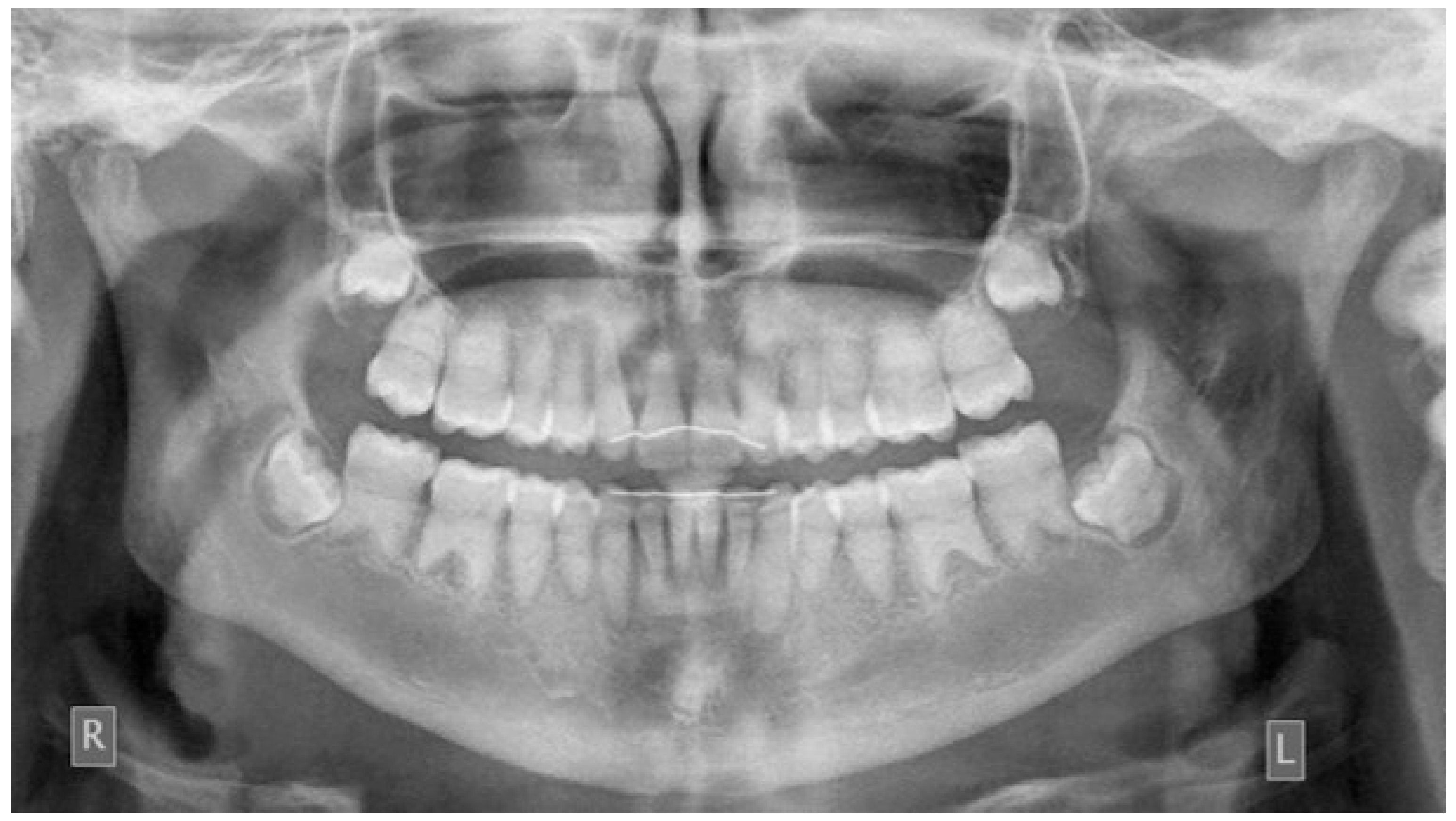 Children 08 00519 g011 Children 08 00519 g011