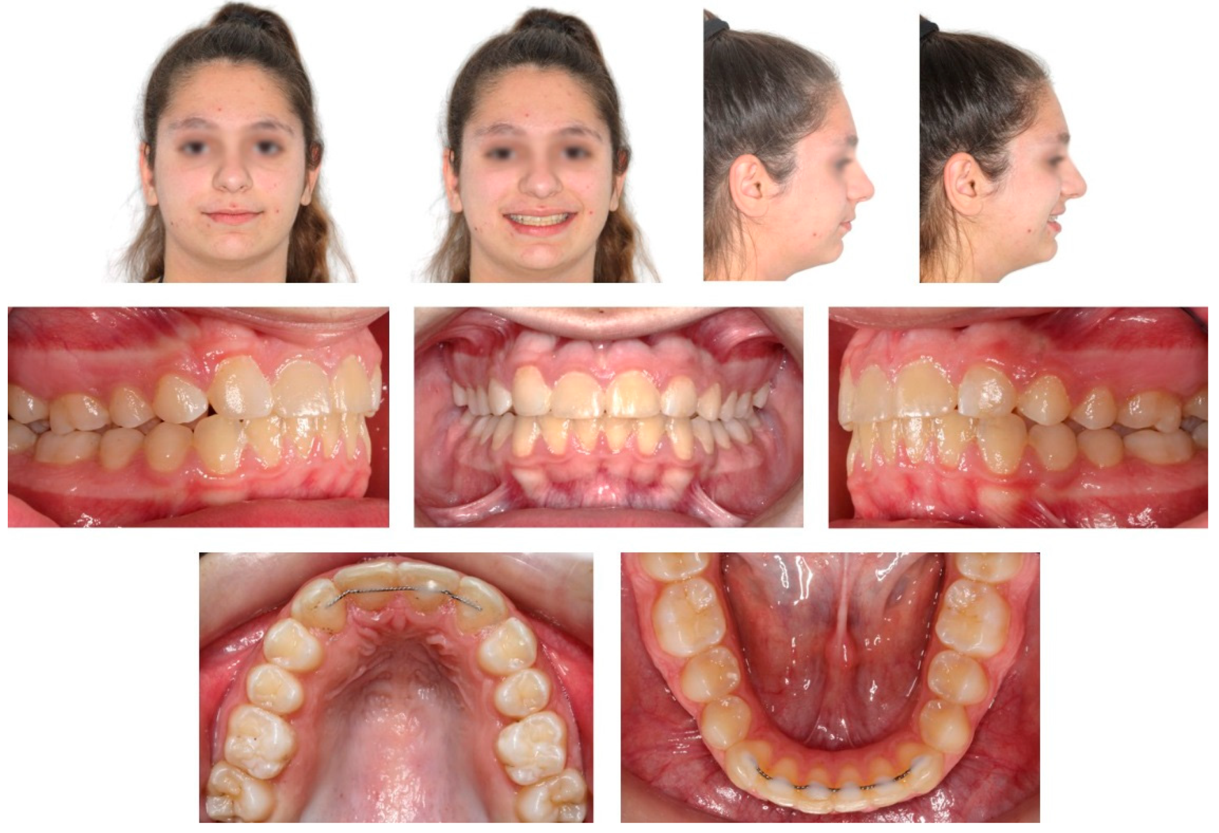 Children 08 00519 g012 Children 08 00519 g012