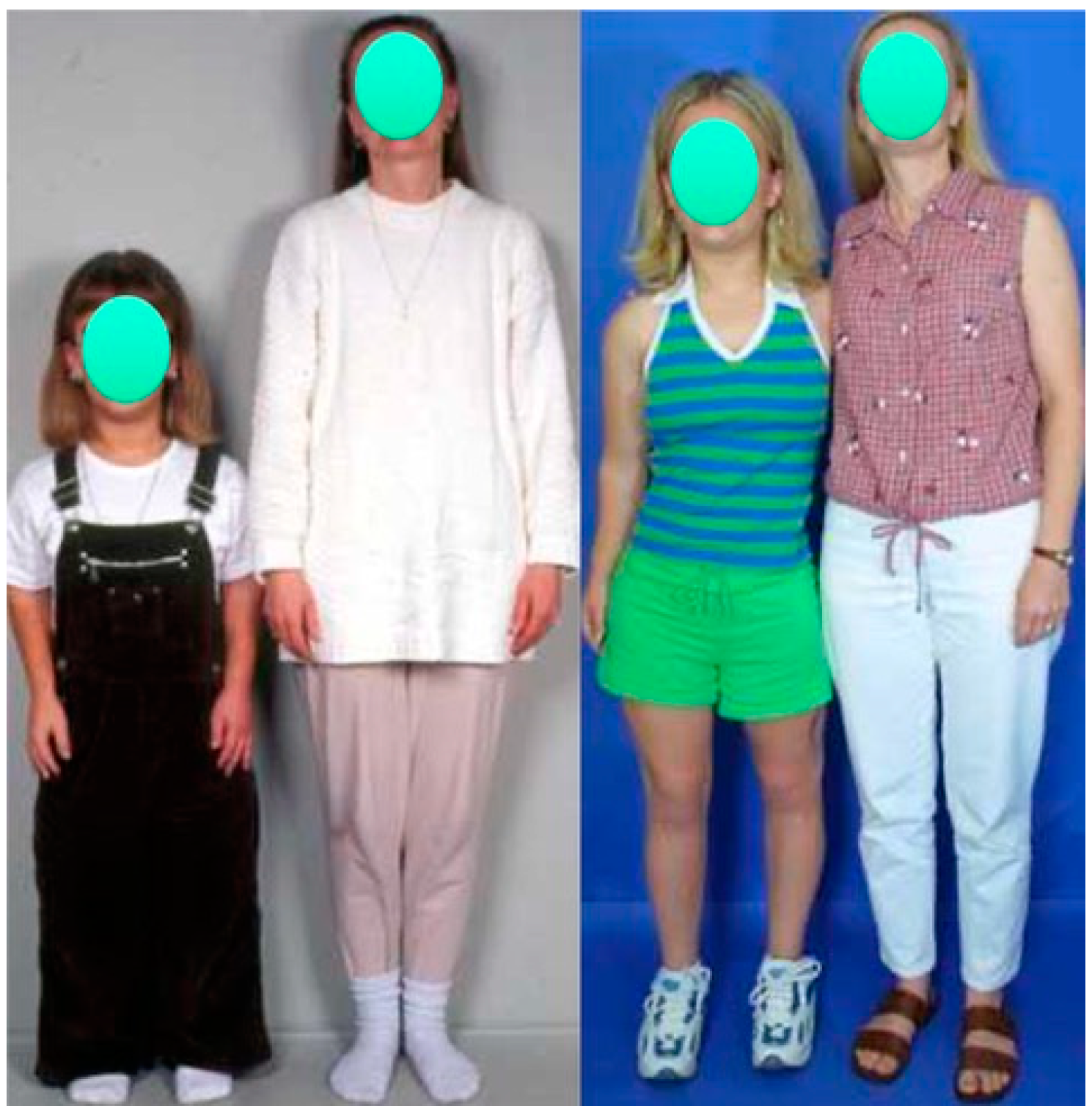 Children 08 00540 g001