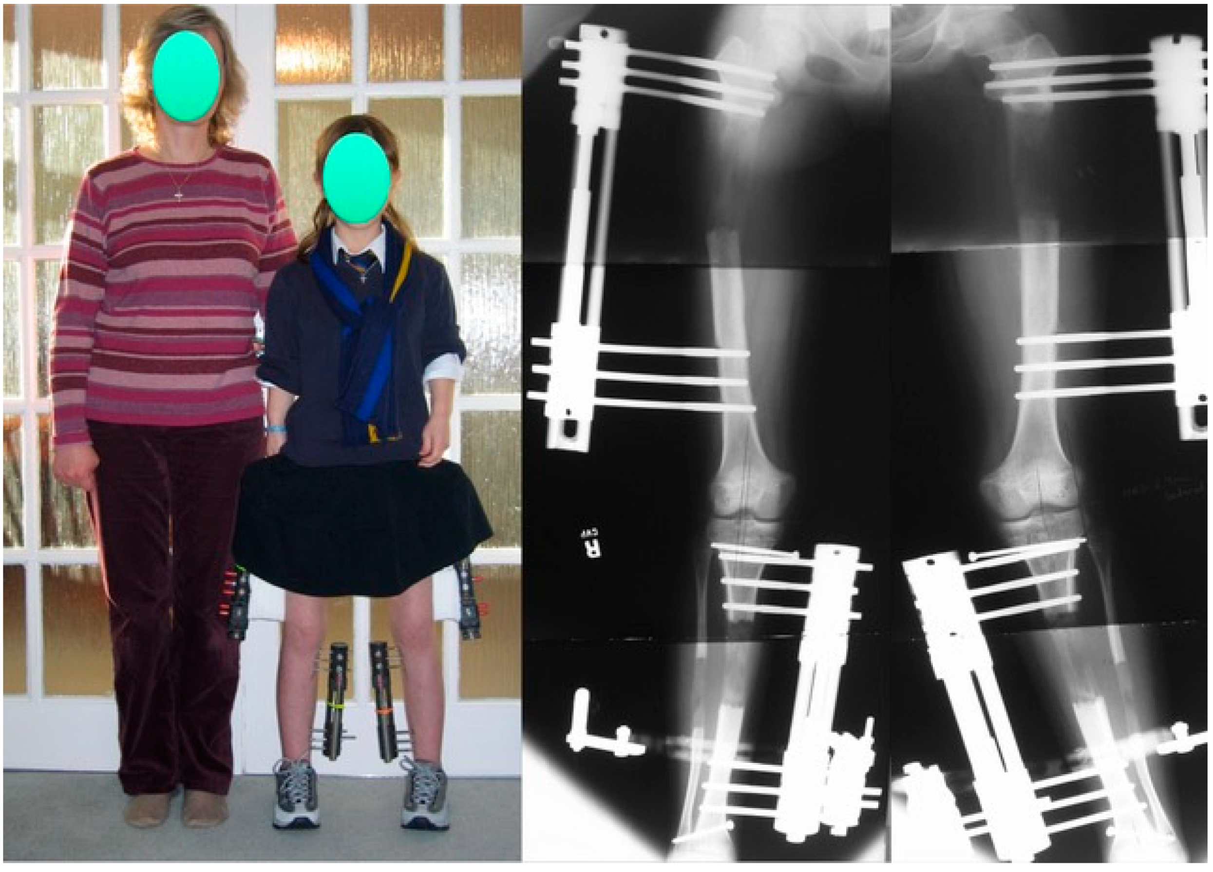 Children 08 00540 g004