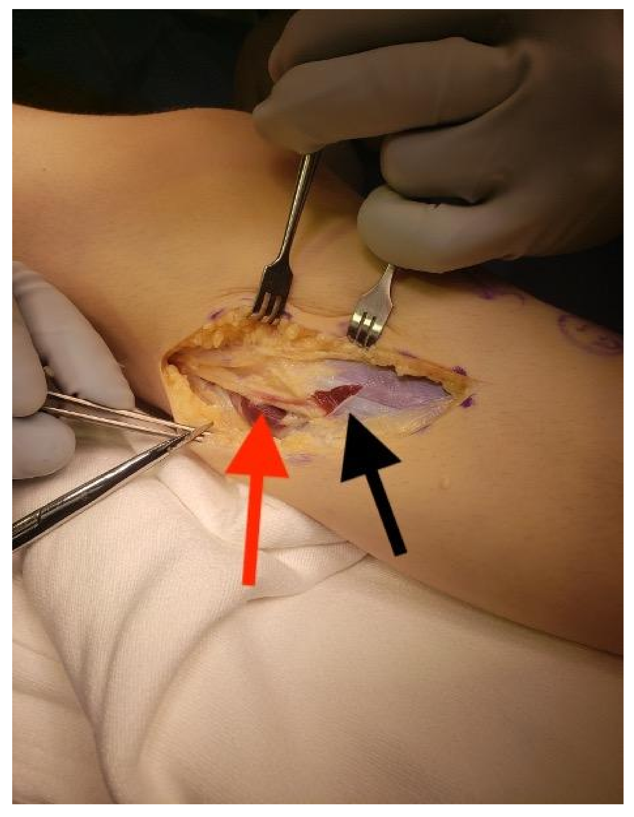 Children 08 00546 g004 550