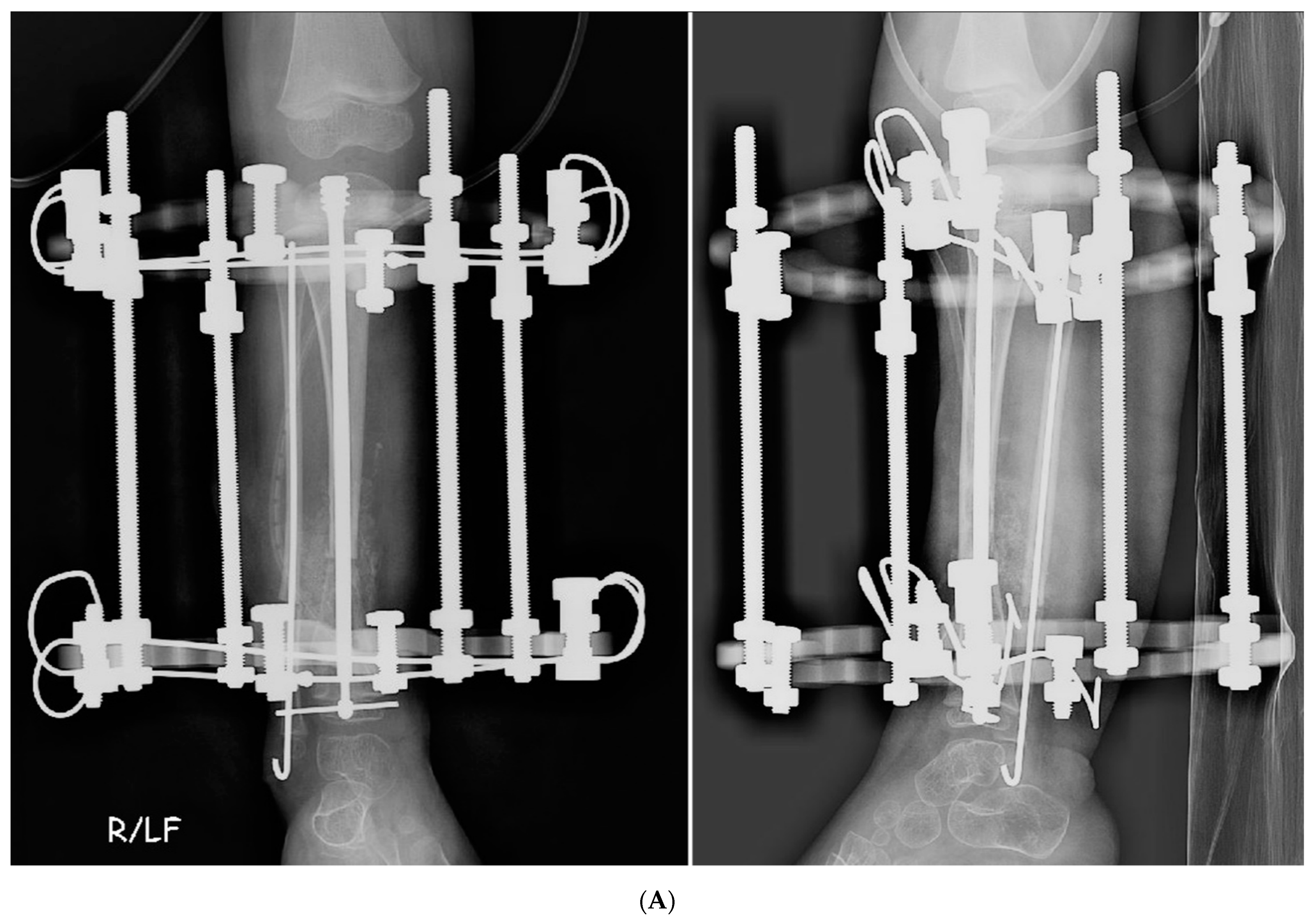 Rank - Tibia Fórum